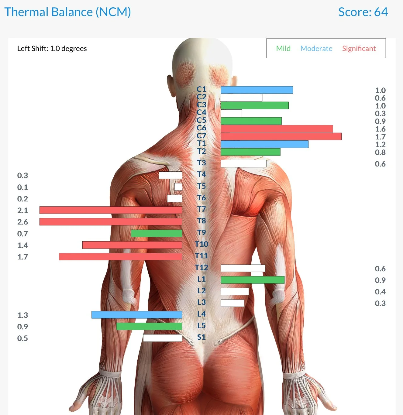 🔍 What Is the CLA Insight Scan?

The CLA Insight Scan is a set of advanced neuroTECH assessments, including sEMG, thermal, and HRV, designed to measure spinal cord tension, stress responses, and overall nerve communication. No radiation. No discomfo