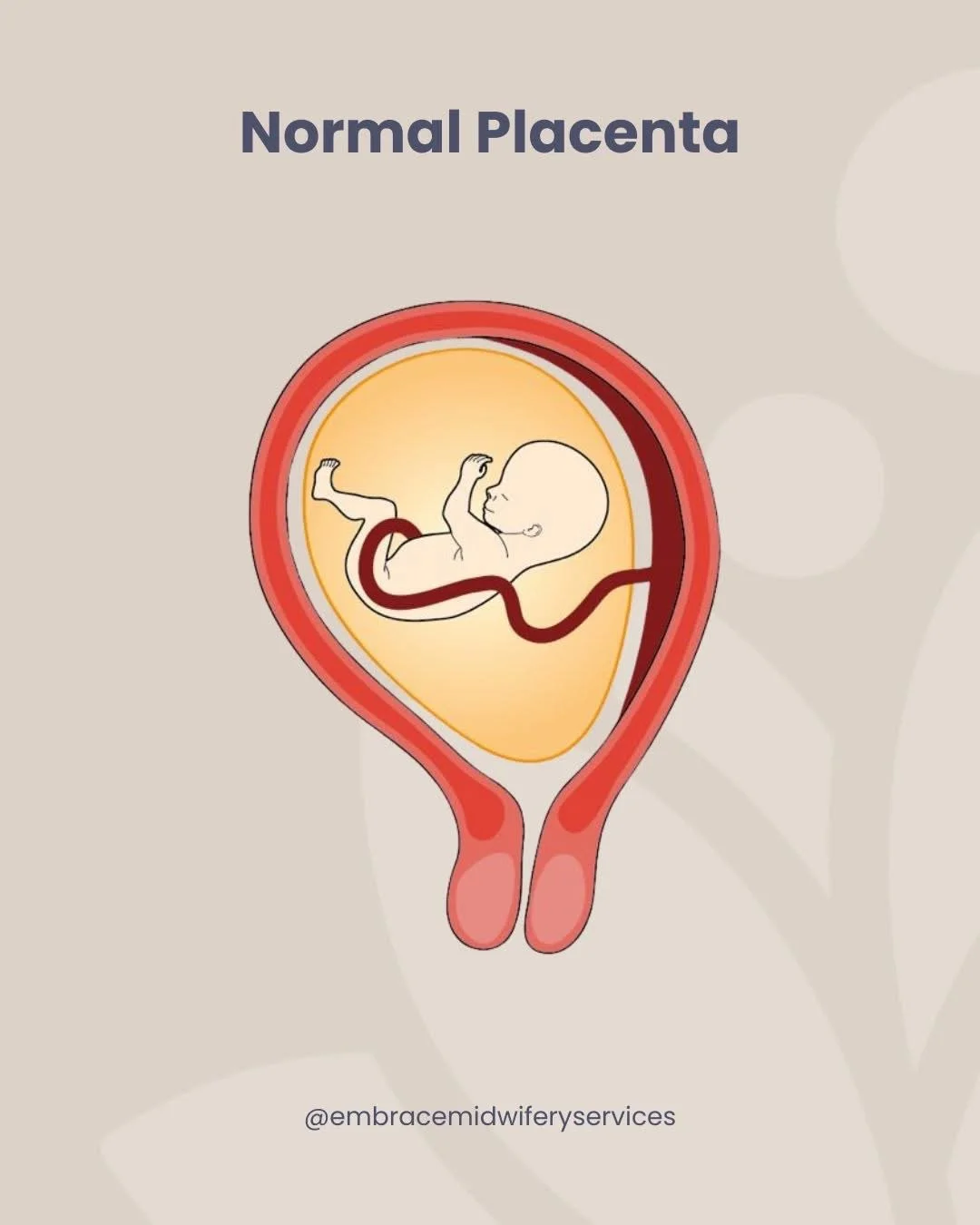 𝐏𝐥𝐚𝐜𝐞𝐧𝐭𝐚 𝐏𝐫𝐞𝐯𝐢𝐚: 𝐖𝐡𝐚𝐭 𝐄𝐱𝐩𝐞𝐜𝐭𝐢𝐧𝐠 𝐏𝐚𝐫𝐞𝐧𝐭𝐬 𝐒𝐡𝐨𝐮𝐥𝐝 𝐊𝐧𝐨𝐰 ✨

Placenta previa is a pregnancy condition that occurs when the placenta implants low in the uterus and covers part or all of the cervix. As the baby nee