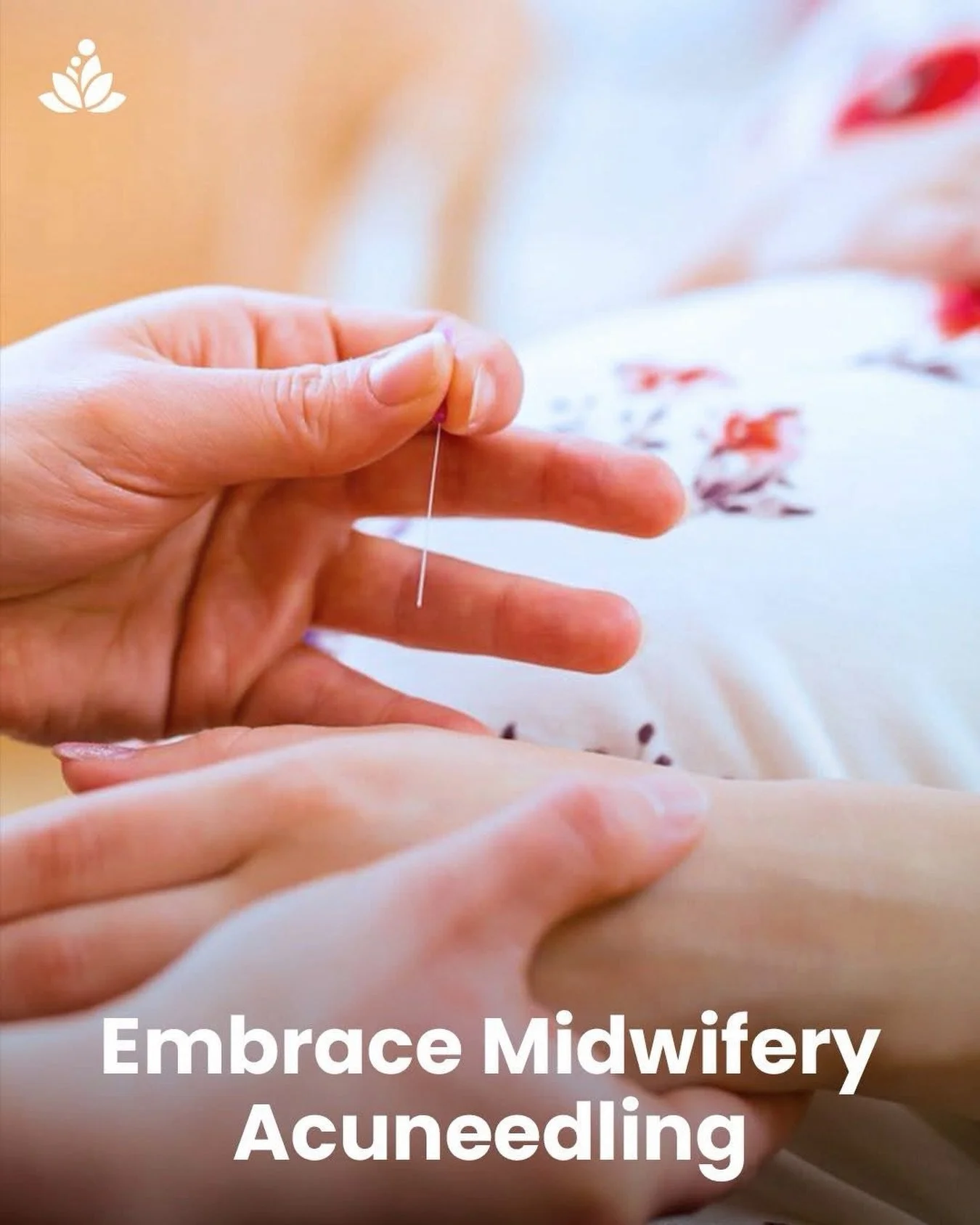 Embrace Midwifery Services offers &lsquo;Specialised Midwifery Acuneedling&rsquo; for pre-conception, managing symptoms of hyperemesis (HG) in pregnancy, labour preparation, and postnatal mother warming.

Acuneedling can support you through pregnancy
