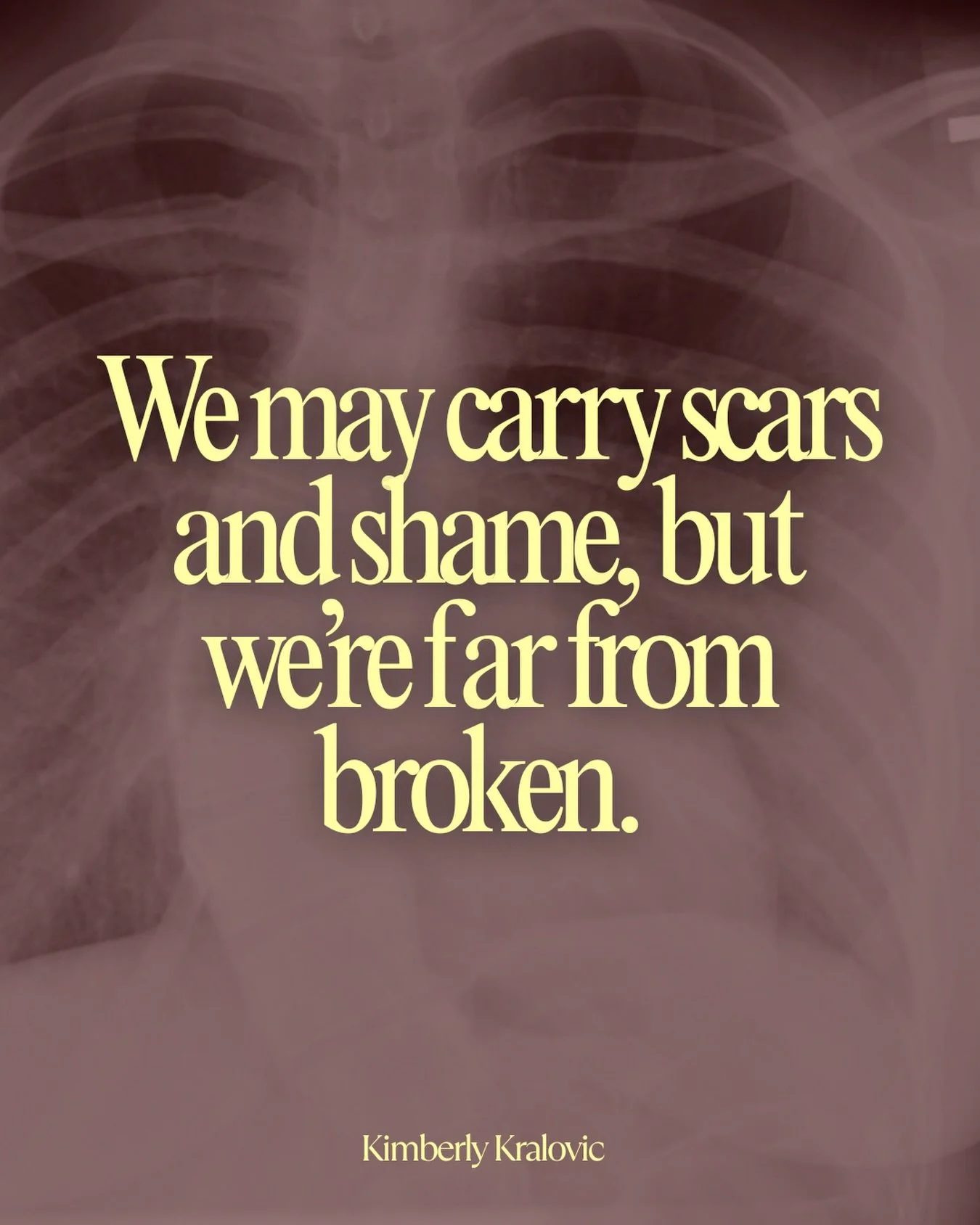 &ldquo;Scoliosis is a part of my identity.&rdquo; ✨

Collectively, it&rsquo;s a true statement and one I couldn&rsquo;t help but think about since I was seven. Yet the other half of me knows it&rsquo;s only a tiny glimpse of my life.

However, scolio