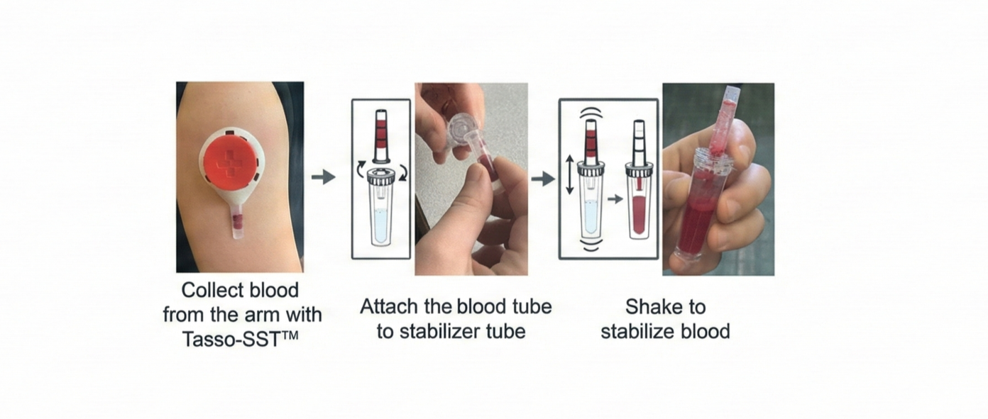 homeRNA: A Self-Sampling Kit for the Collection of Peripheral Blood and Stabilization of RNA