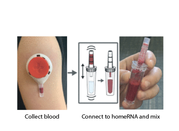 homeRNA: A Self-Sampling Kit for the Collection of Peripheral Blood and Stabilization of RNA