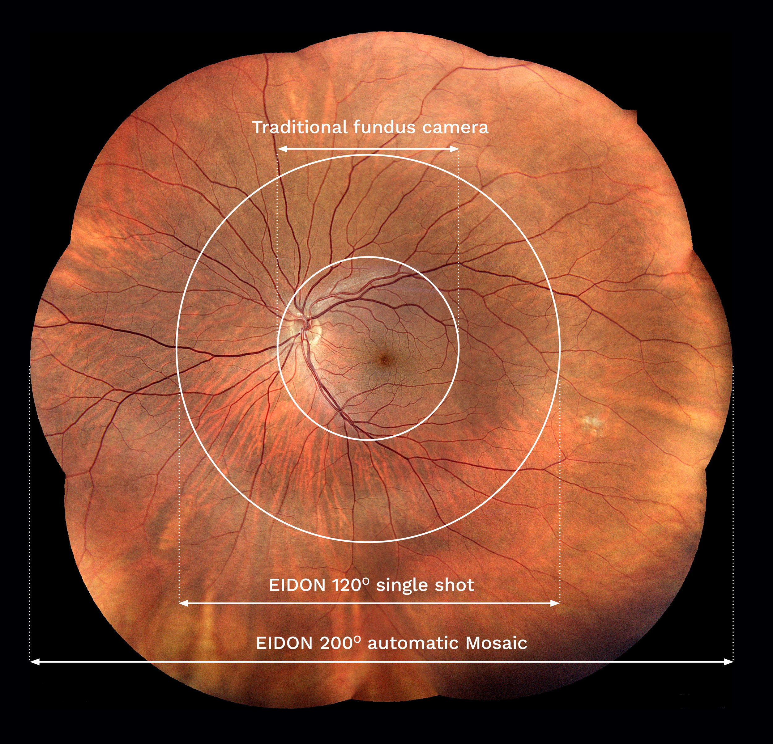 Retina_with_dimensions_FAMILY_RGB_DIGITAL.png