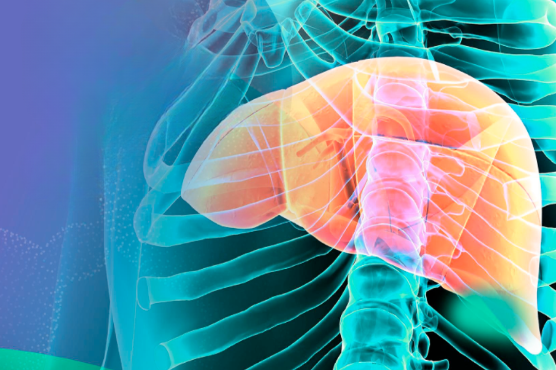 Breaking the Silence: The Case for Action on Fibrosis, MAFLD, and MASH
