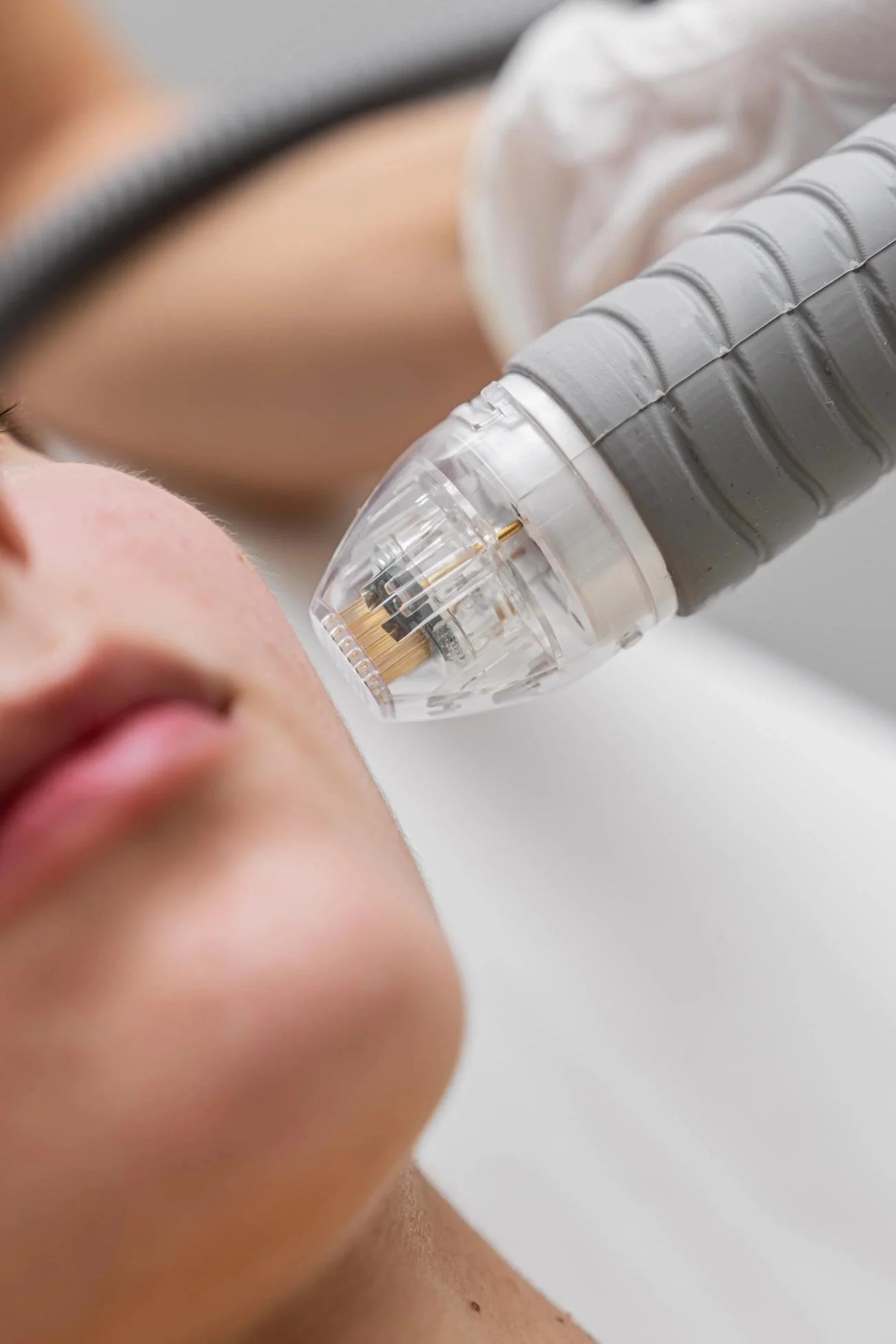 Varicose & Spider Vein Treatment