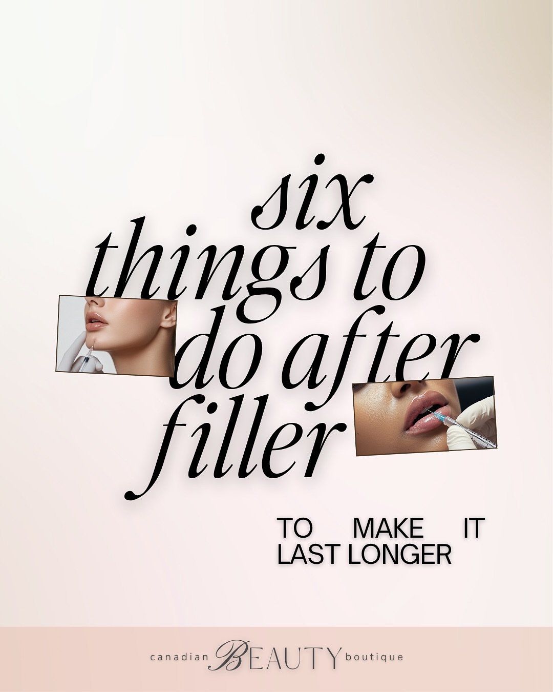 Getting filler is just the beginning! 𝐾𝑒𝑒𝑝𝑖𝑛𝑔 𝑖𝑡 𝑙𝑜𝑜𝑘𝑖𝑛𝑔 𝑓𝑟𝑒𝑠ℎ?

𝐓𝐡𝐚𝐭&rsquo;𝐬 𝐰𝐡𝐞𝐫𝐞 𝐬𝐦𝐚𝐫𝐭 𝐚𝐟𝐭𝐞𝐫𝐜𝐚𝐫𝐞 𝐜𝐨𝐦𝐞𝐬 𝐢𝐧:

➜ Drink water (Hyaluronic Acid loves hydration)
➜ Use medical-grade skincare
➜ SPF = non