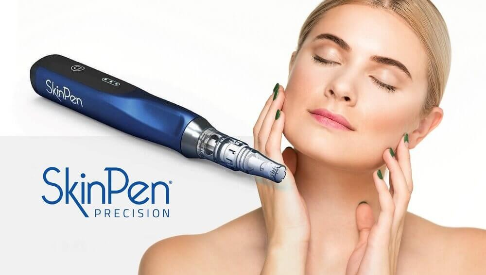 Microneedling at Canadian Beauty Boutique Whitby, Toronto &amp; London, ON