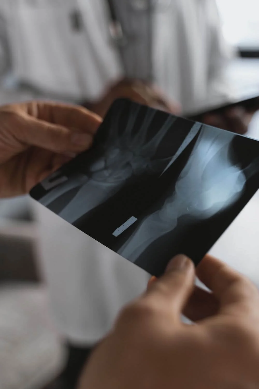 touch thumb joint replacement surgery tri cities washington