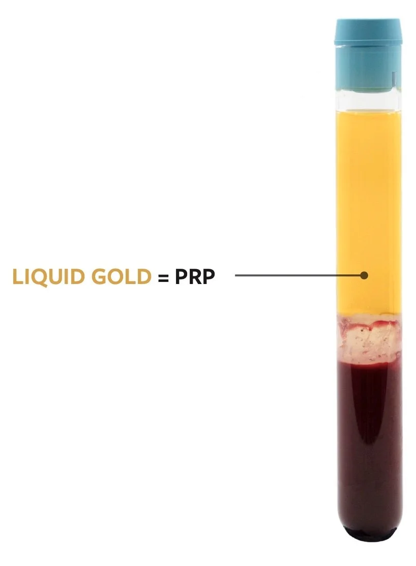 LiquidGold PRP therapy kennewick washington hand wrist elbow orthopedic