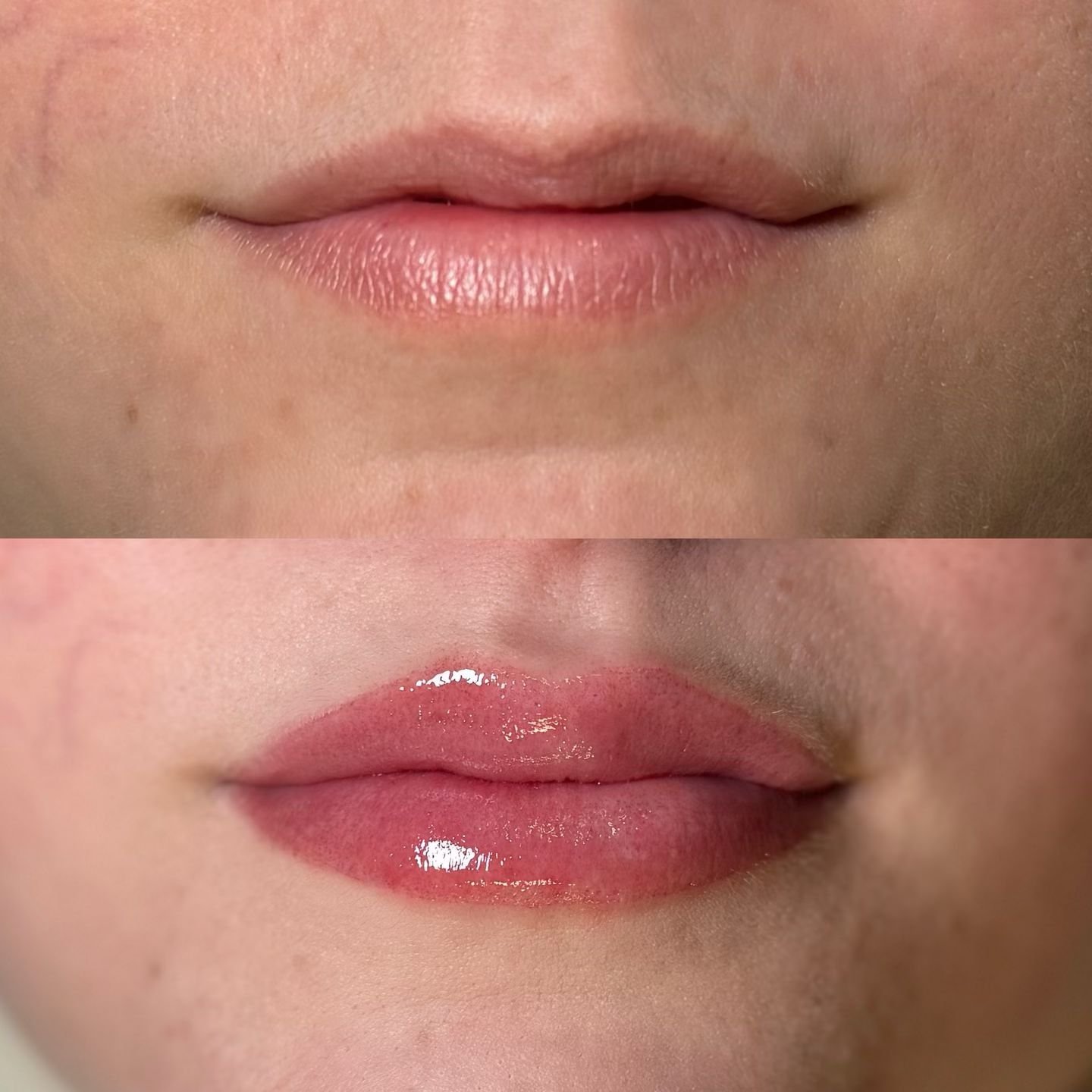 💋

One less thing to do in the morning! 

Before &amp; After 
Service: Lip Blush 
Artist: @dtbeauty.huney

#lips #pmu #lipblush #beforeandafter