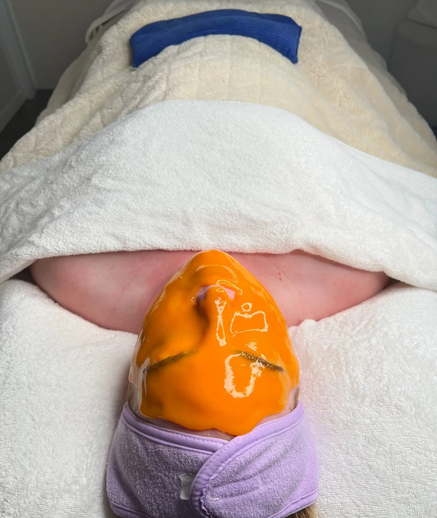 AHA BHA Hydrojelly 🧡

Tailoring this fruit enzyme Hydrojelly mask to our client to focus on brightening the skin, improving pores/texture and anti-ageing for elasticised/firm skin. 

Have you tried our signature $99 facials? For 60 minutes our $99 f