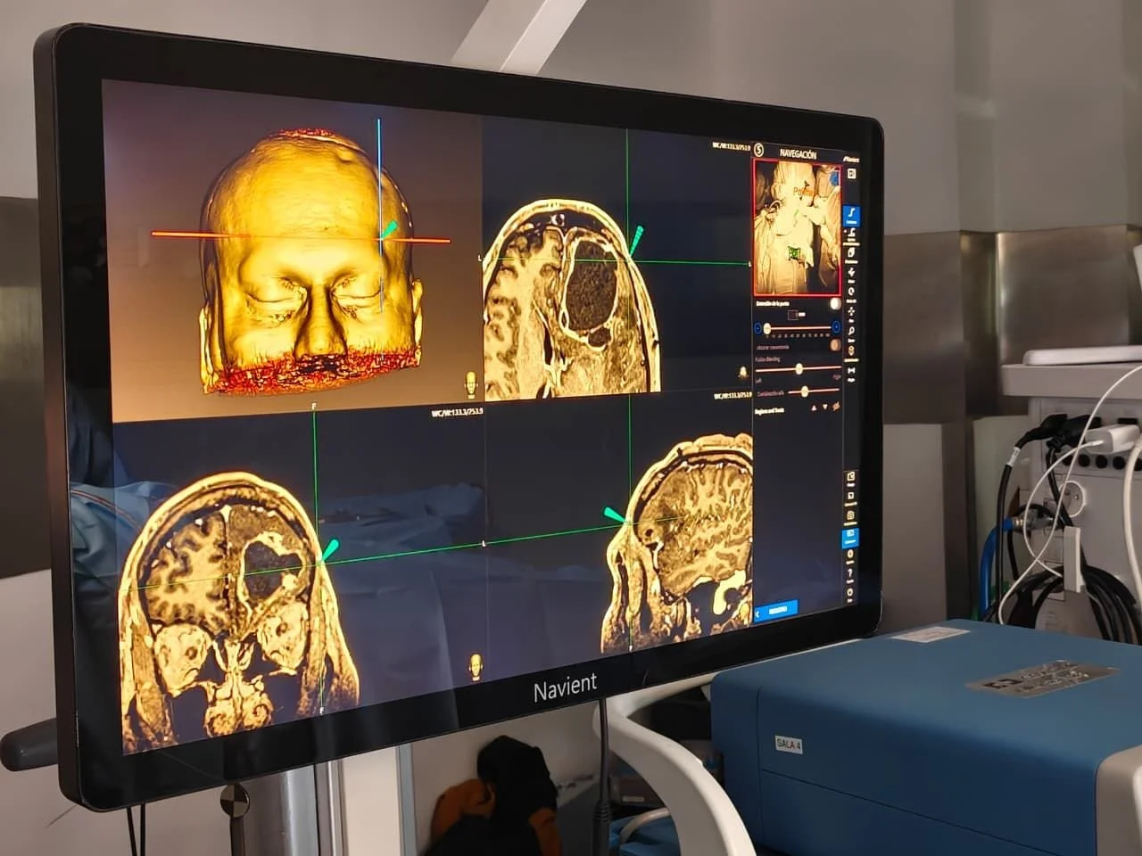 Monitor Navient con cortes multiplanares y reconstrucción 3D de imágenes craneales