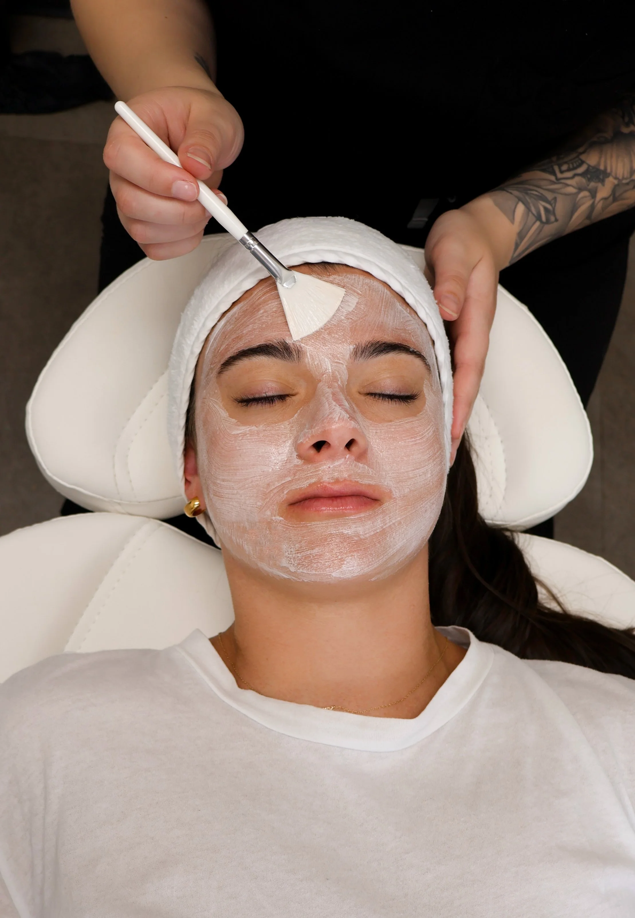 The Perfect Derma Peel in Red Deer, Alberta: A Complete Guide to Radiant Skin Renewal