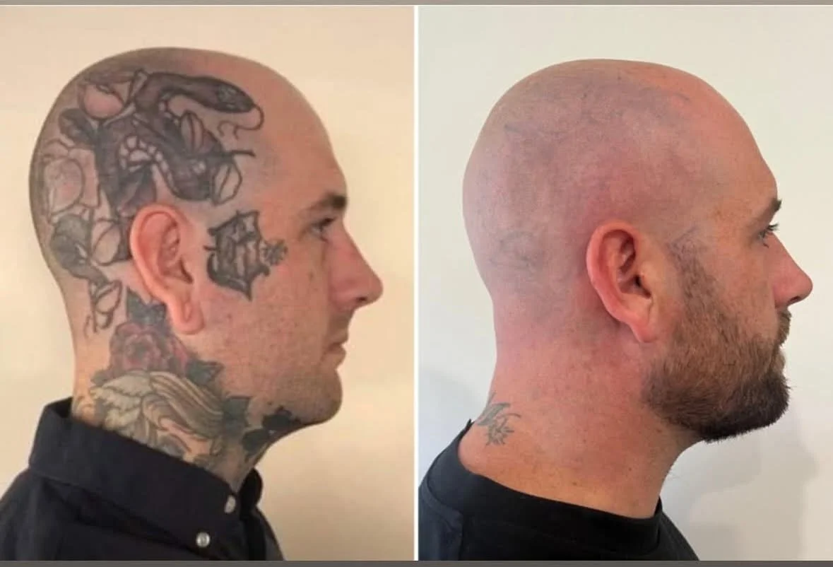head tattoo 1.jpg