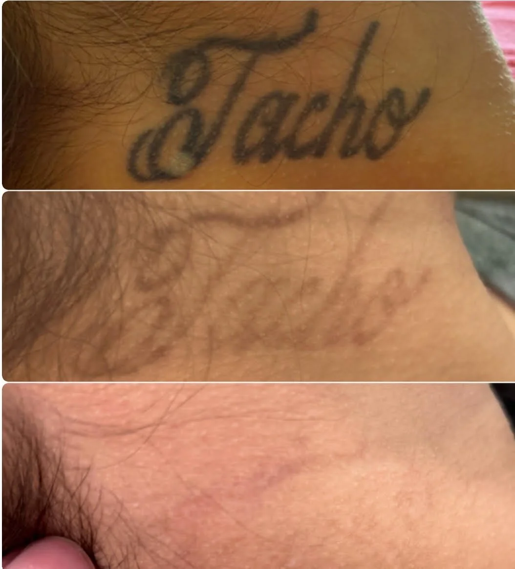 neck tattoo 1.jpg