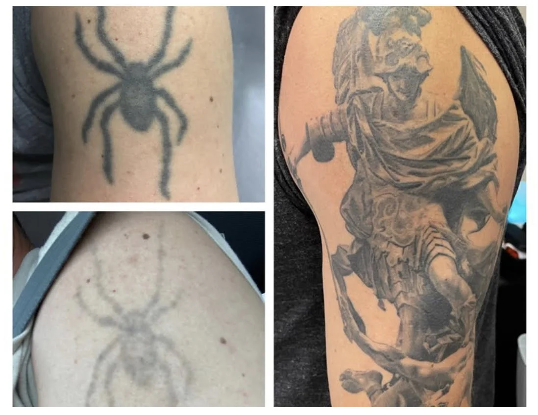 shoulder tattoo 1.jpg
