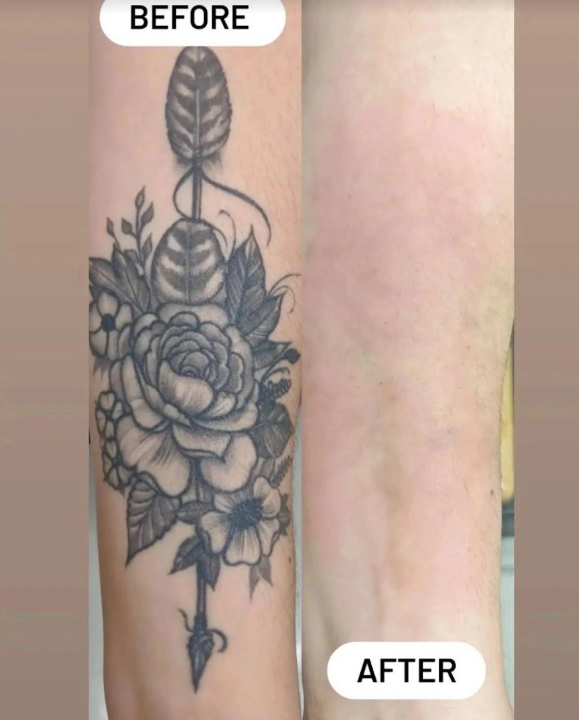 arm tattoo 1.jpg
