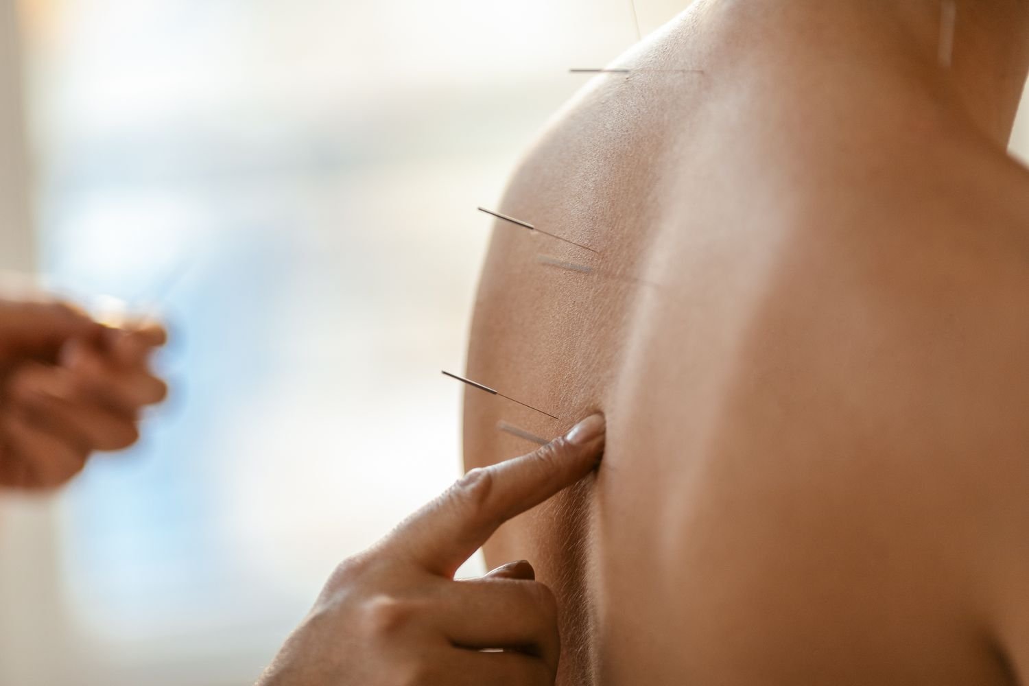 How does acupuncture work?
