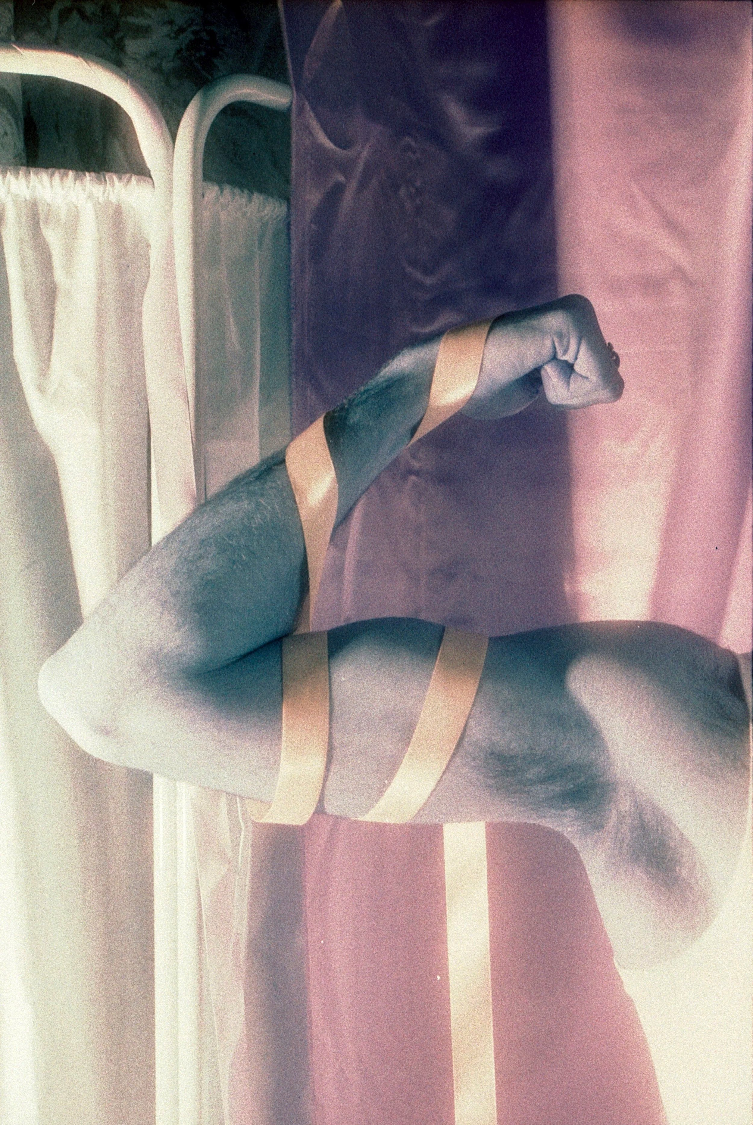 Legs wrapped in beige bandage tape lying on a hospital-style bed, shot on film. By Hartenjager.