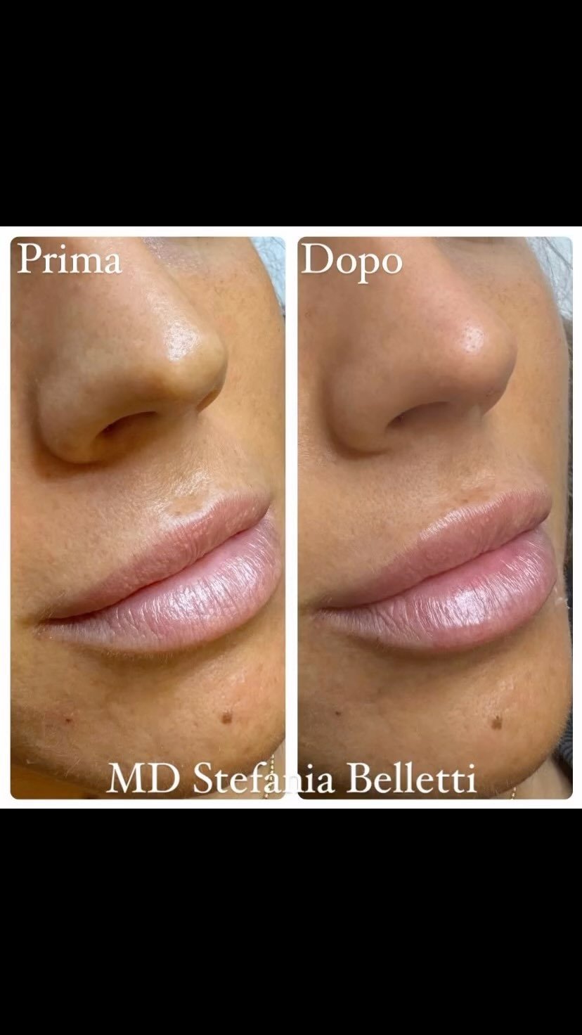 Diapositiva 10