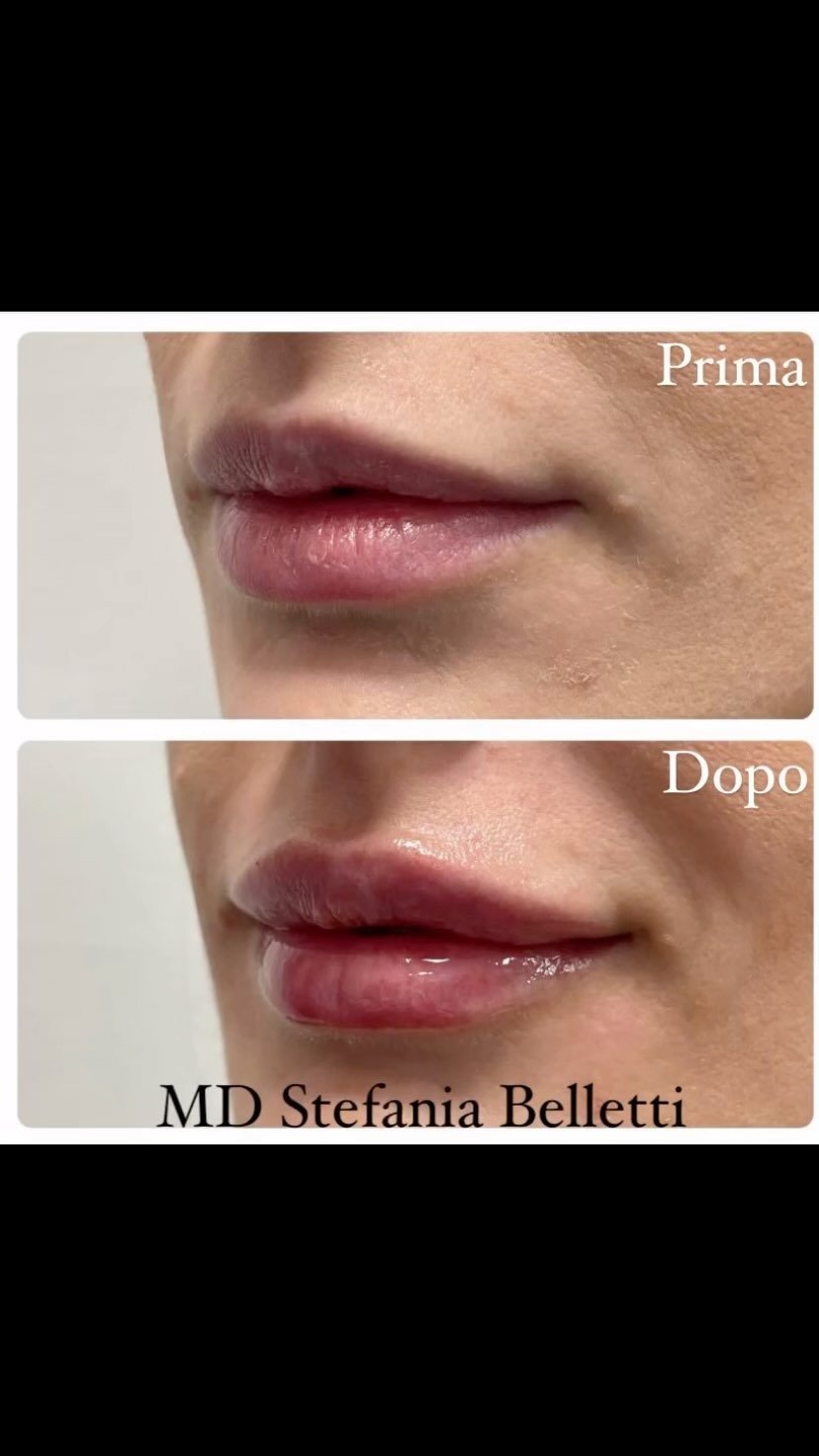 Diapositiva 9