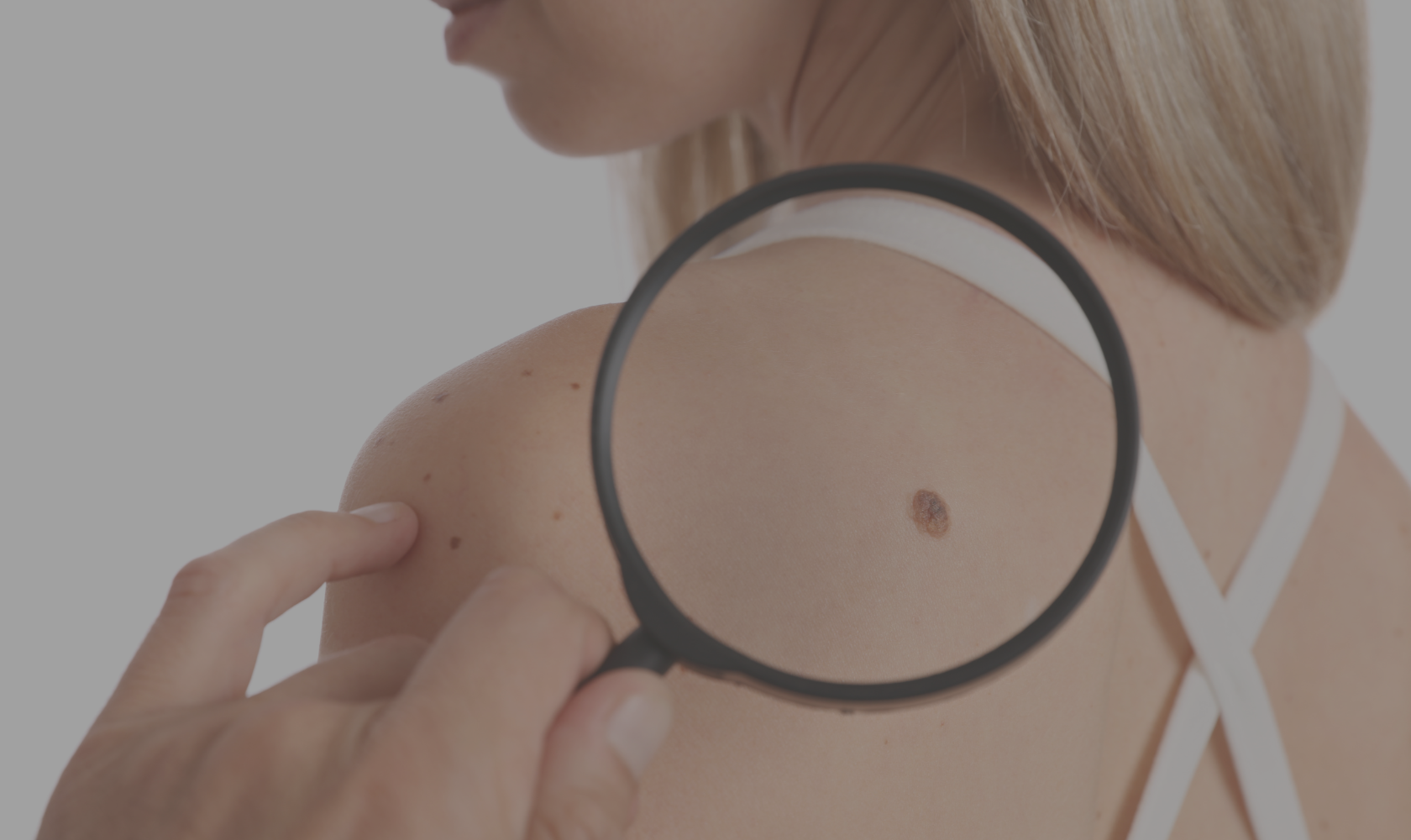 A close-up of a woman's shoulder with a magnifying glass examining a mole on her skin.