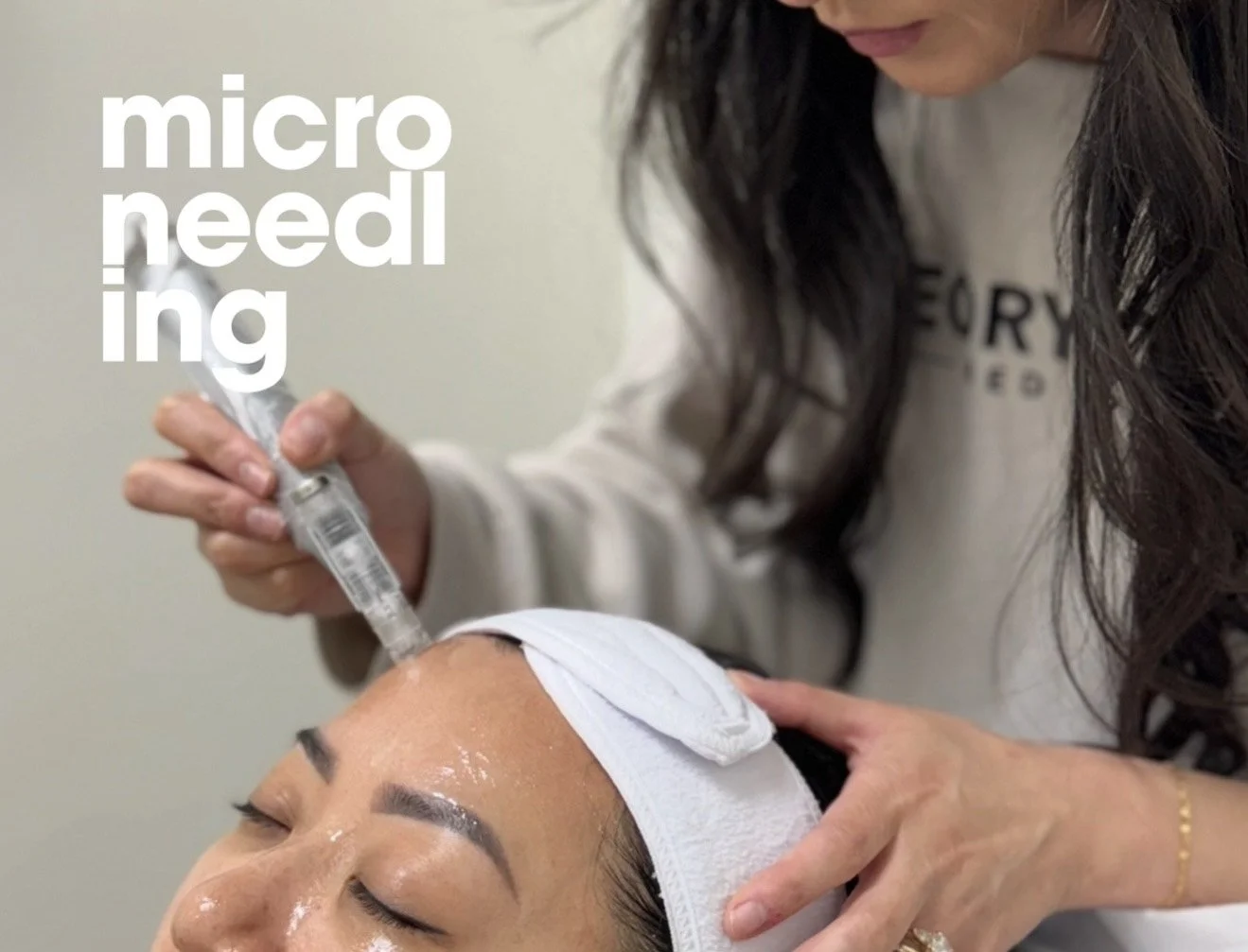 A person receiving a micro-needling treatment on their face from a skincare professional, with the patient lying down and eyes closed, while the professional operates a device on the patient's forehead.