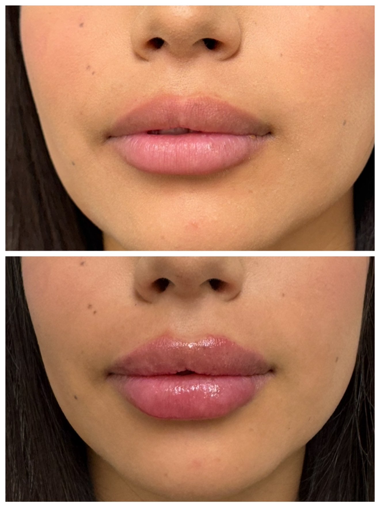 Close-up of a woman's lips, before and after applying lip gloss, showing a natural lip shape and color, with the gloss adding shine and a slightly fuller appearance.