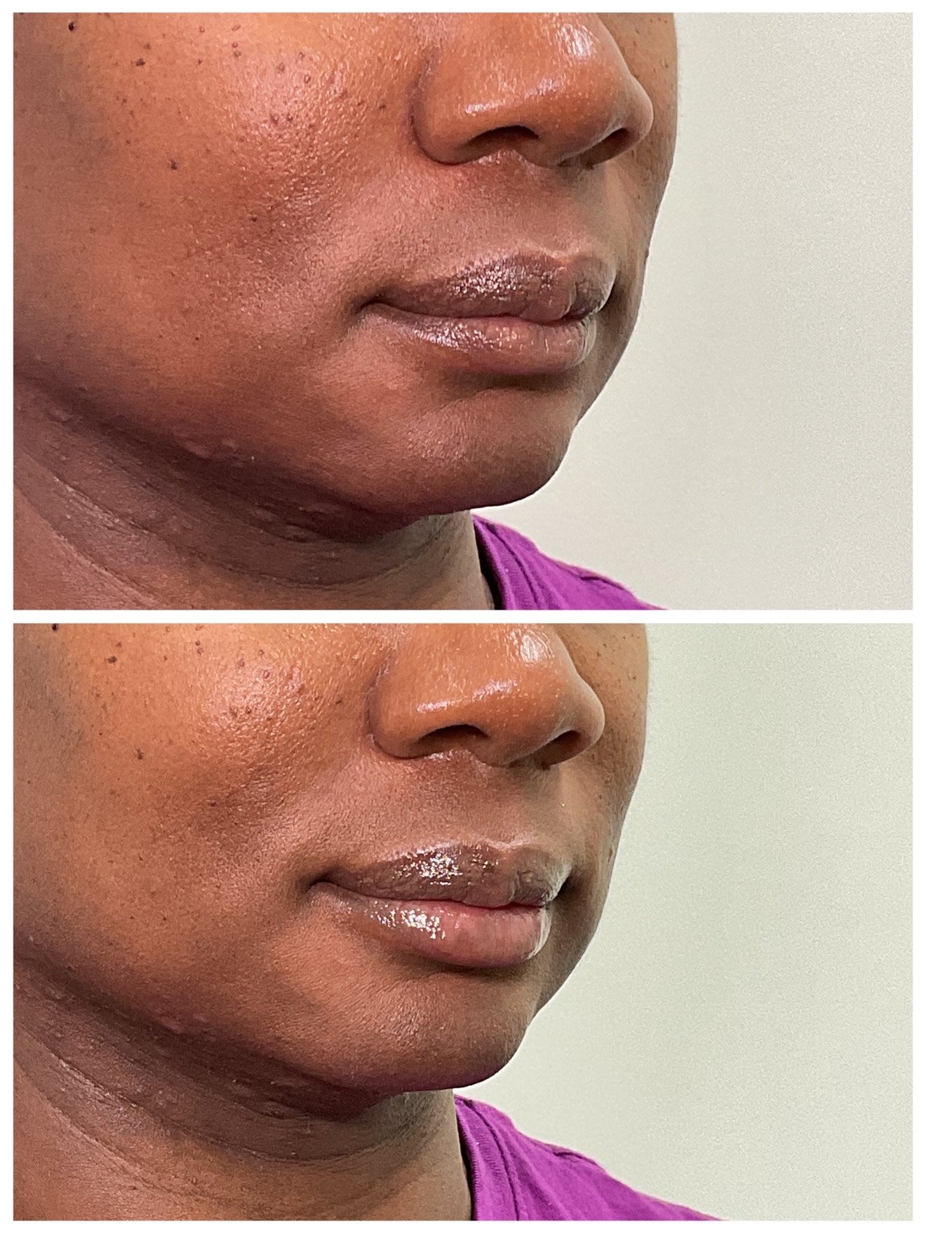 Close-up image of a person's lower face before and after applying lip gloss, with the top showing matte lips and the bottom showing shiny, glossy lips, wearing a purple shirt.