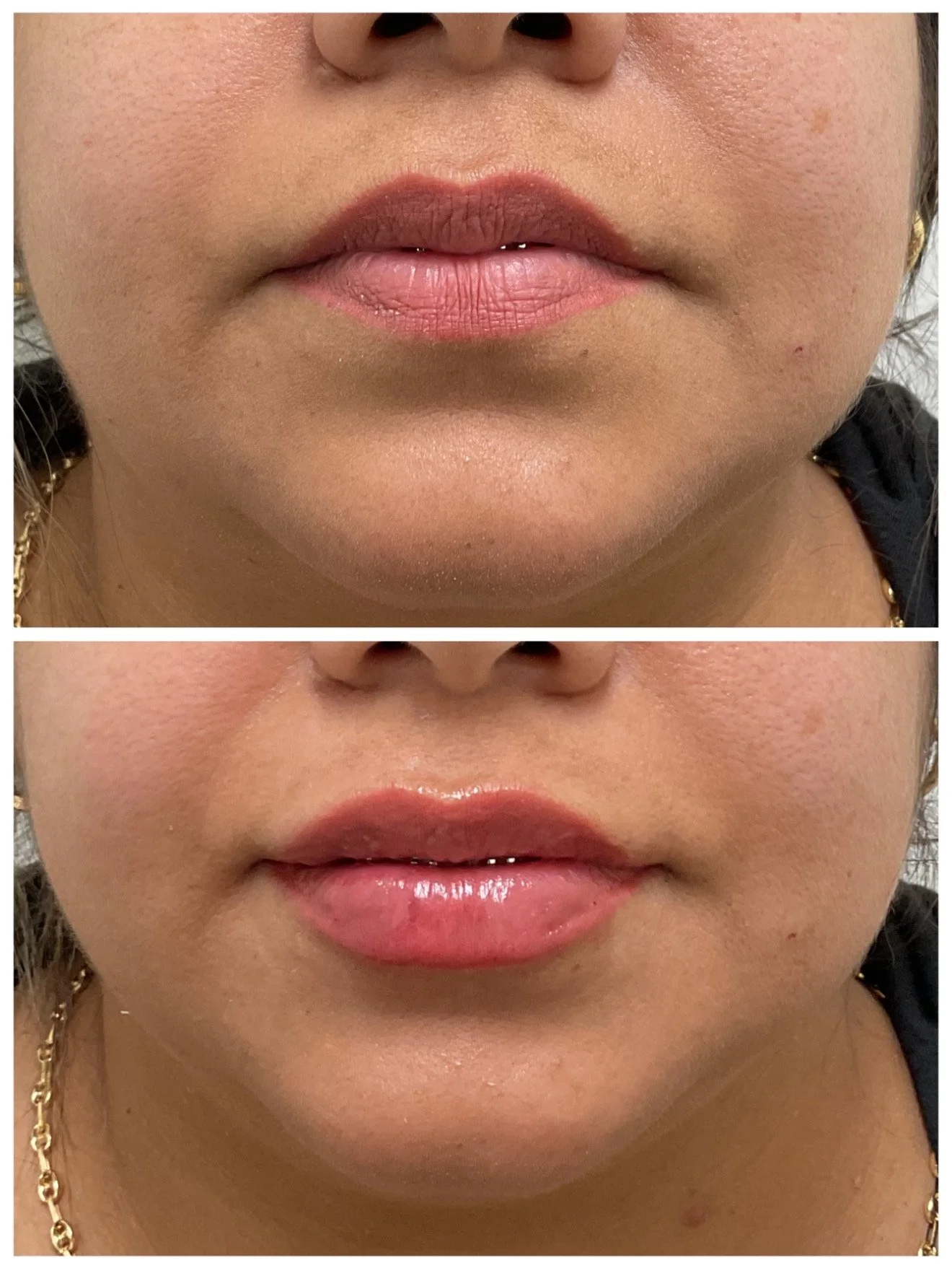 Comparison of lips before and after applying lip gloss, with the gloss making the lips appear shinier and more defined.