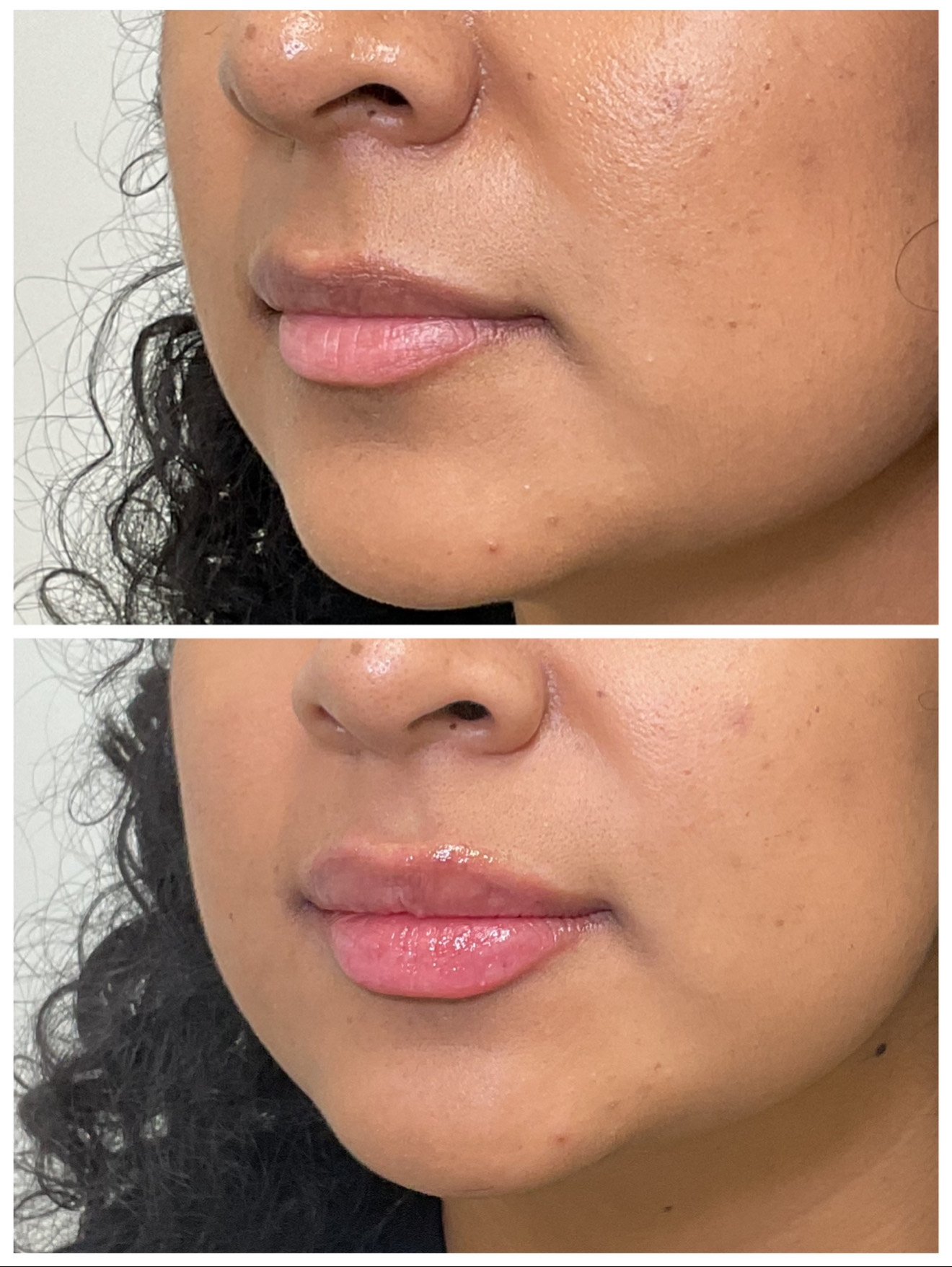 Close-up of a woman's lips before and after applying lip gloss, with visible skin texture and natural features.