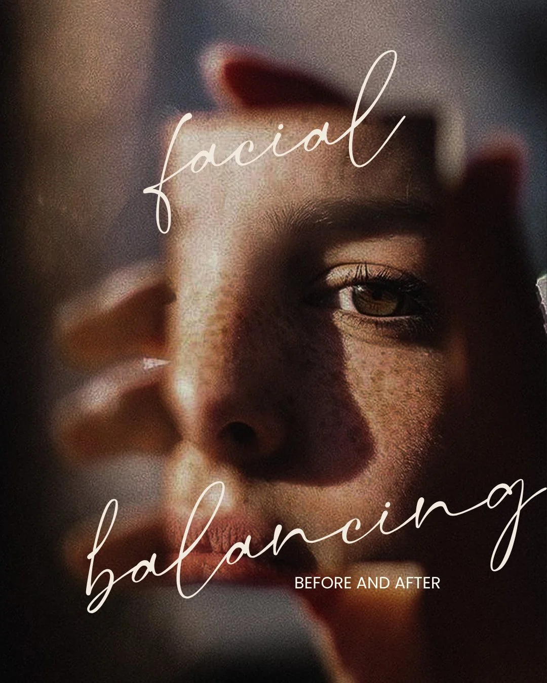 The goal is always simple: treatments that help you feel like the best version of yourself. To achieve these results, we used: ⁠
⁠
&frac12; syringe Kysse for soft, natural lips ⁠
2 syringes Evolysse to smooth chin shadows &amp; marionette lines ⁠
Hyd