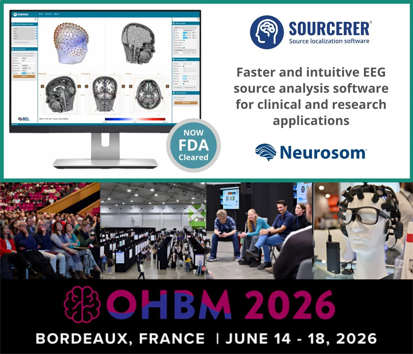 FDA-cleared SOURCERER source localization software for EEG analysis provides an in-depth visual examination of brain activity.