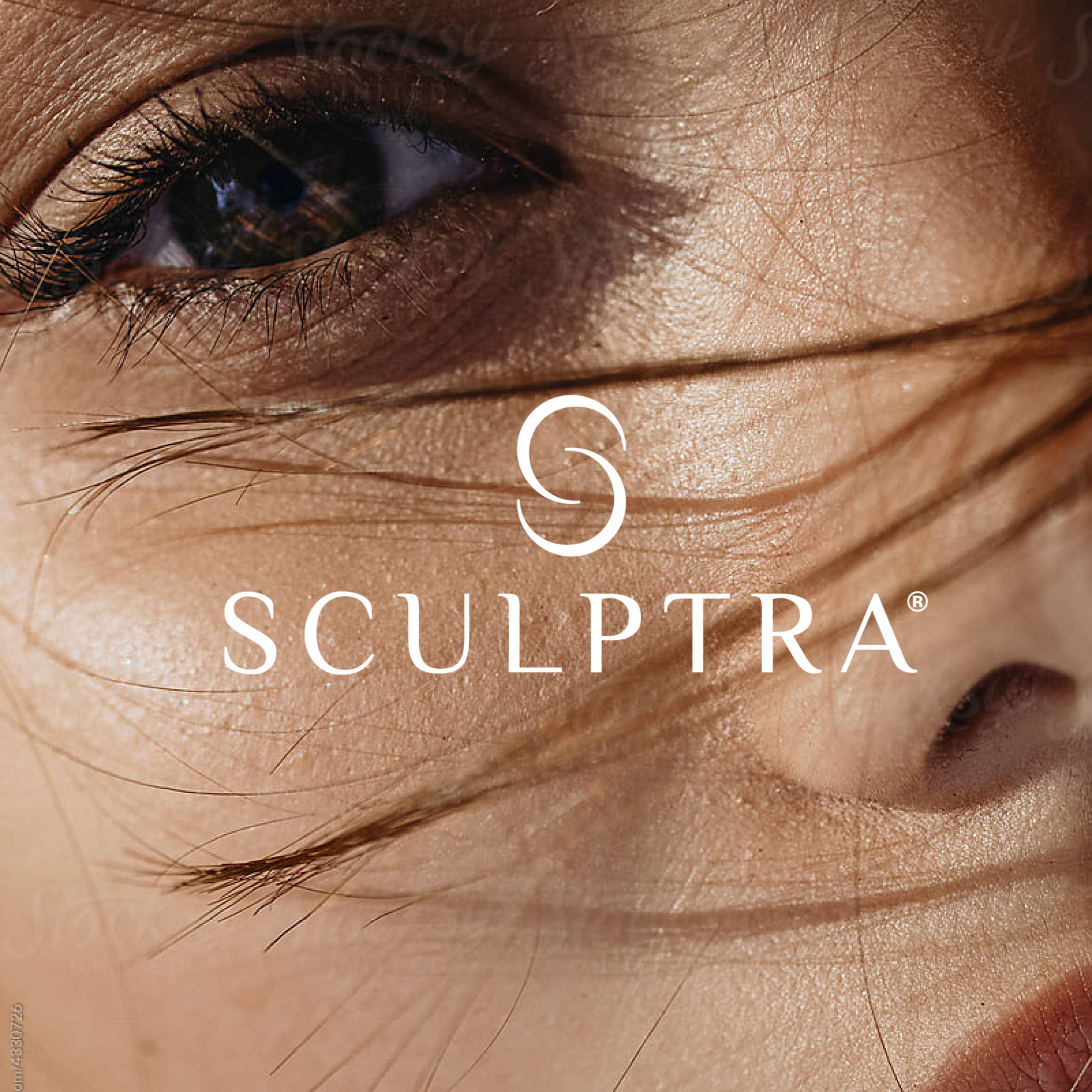 Sculptra treatments at rose milk aesthetics in houston, texas
