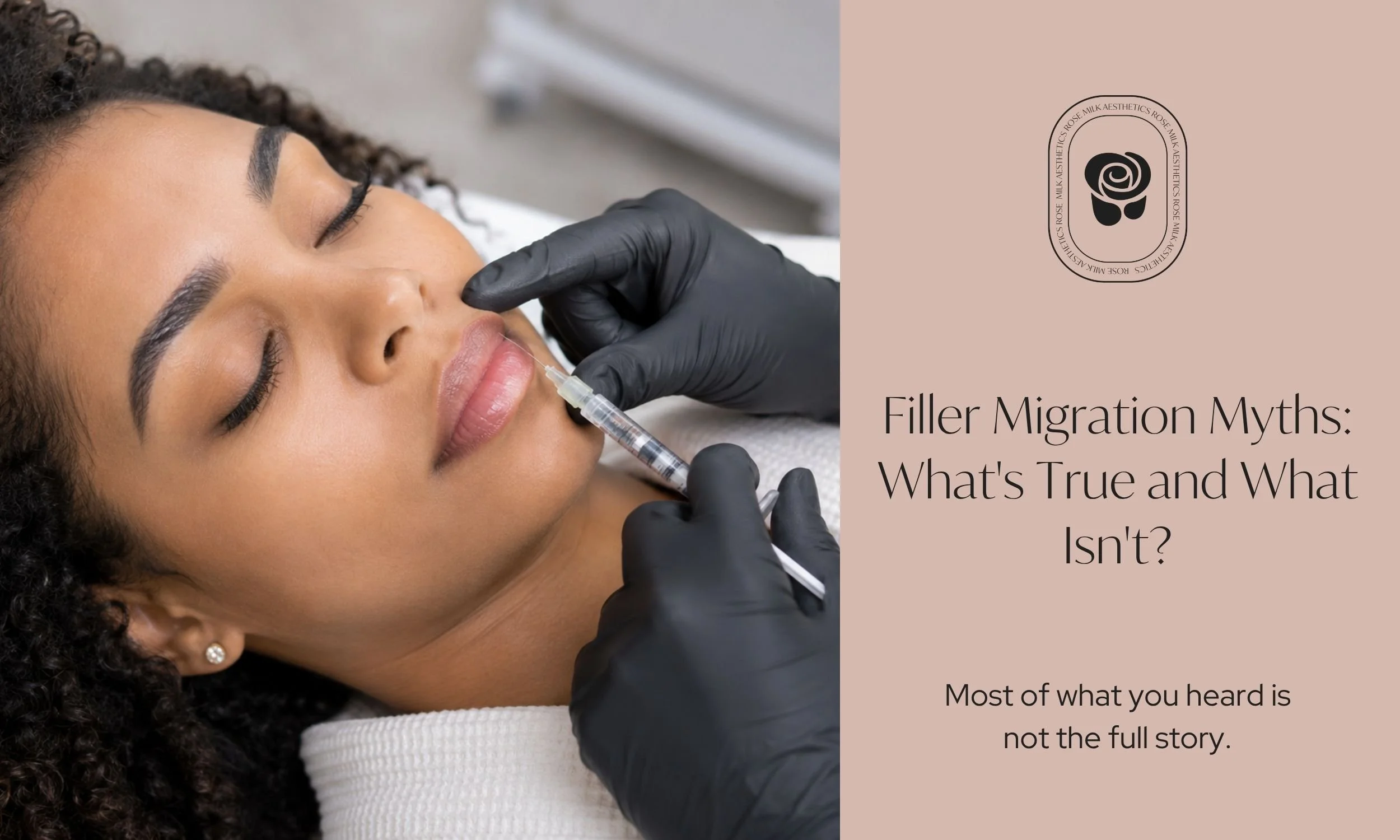 Filler Migration Myths