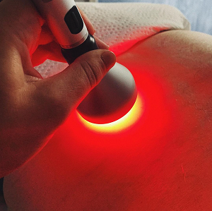 The History of the Term "Photobiomodulation": From Ancient Light Therapies to Modern Standardization