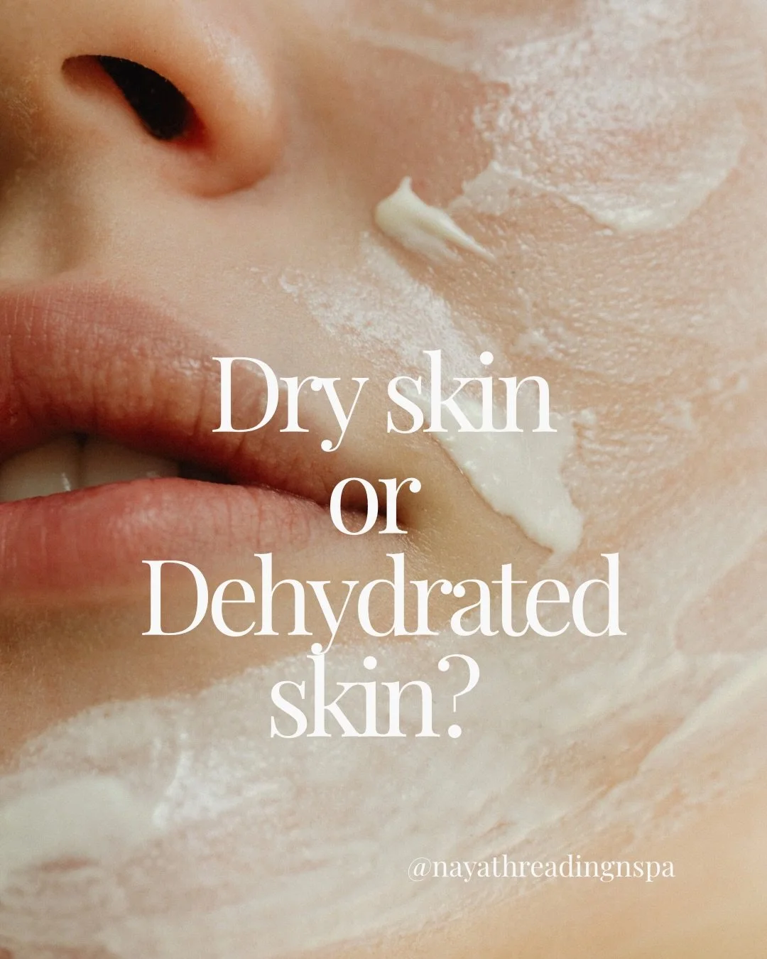 Most people say they have &ldquo;dry skin&rdquo; &mdash; but what they actually have is dehydrated skin.

Dry skin is a skin type.
Dehydrated skin is a skin condition.
Treating the wrong one can lead to irritation, breakouts, or more dryness.

At our