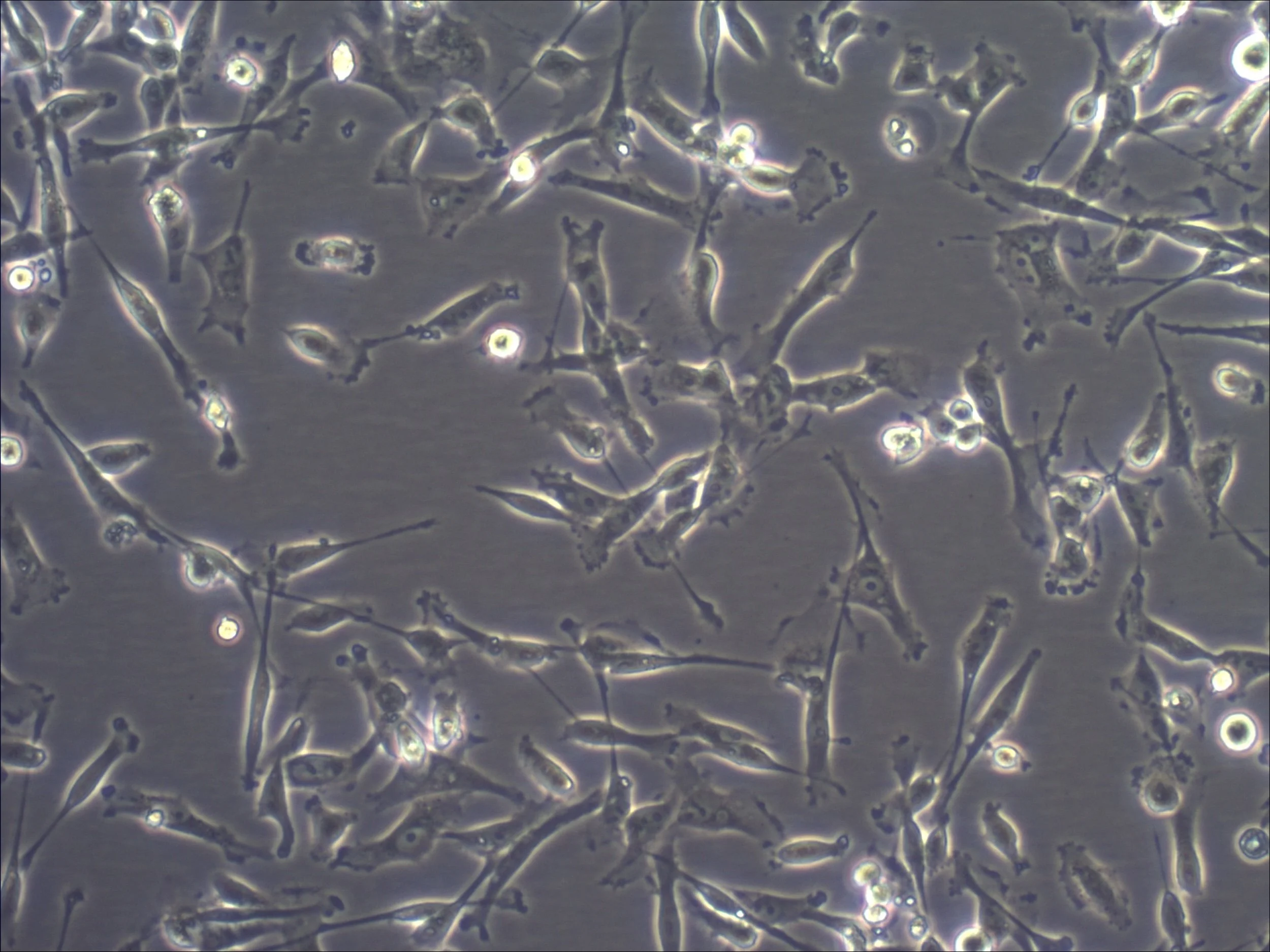 JRA project - Optimising AML Blast and MSC Co-Culture
