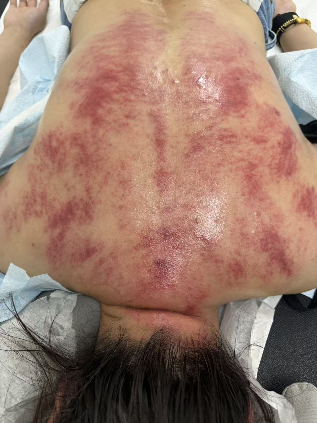 Gua Sha