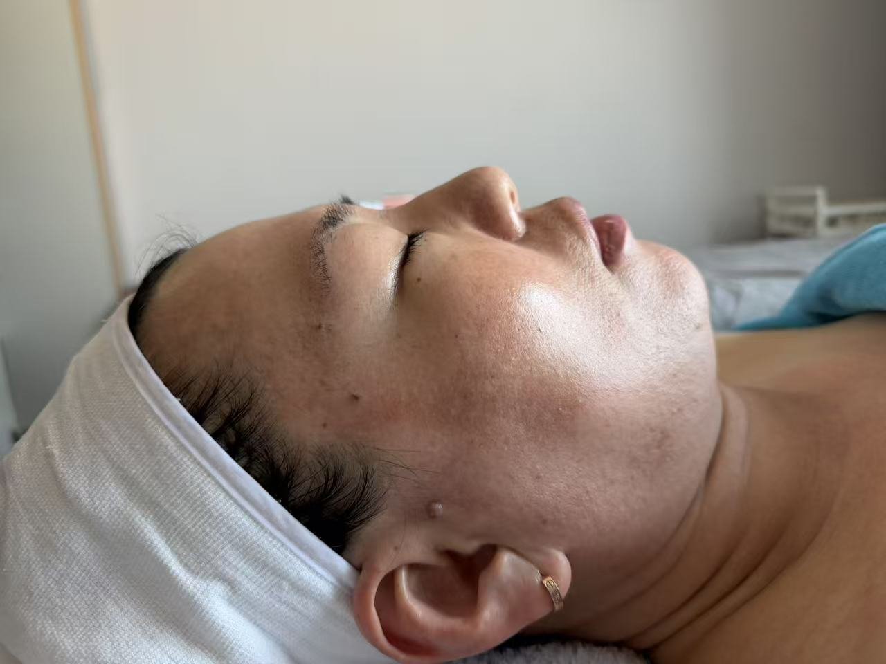 Manual Facial Reshaping & Contouring
