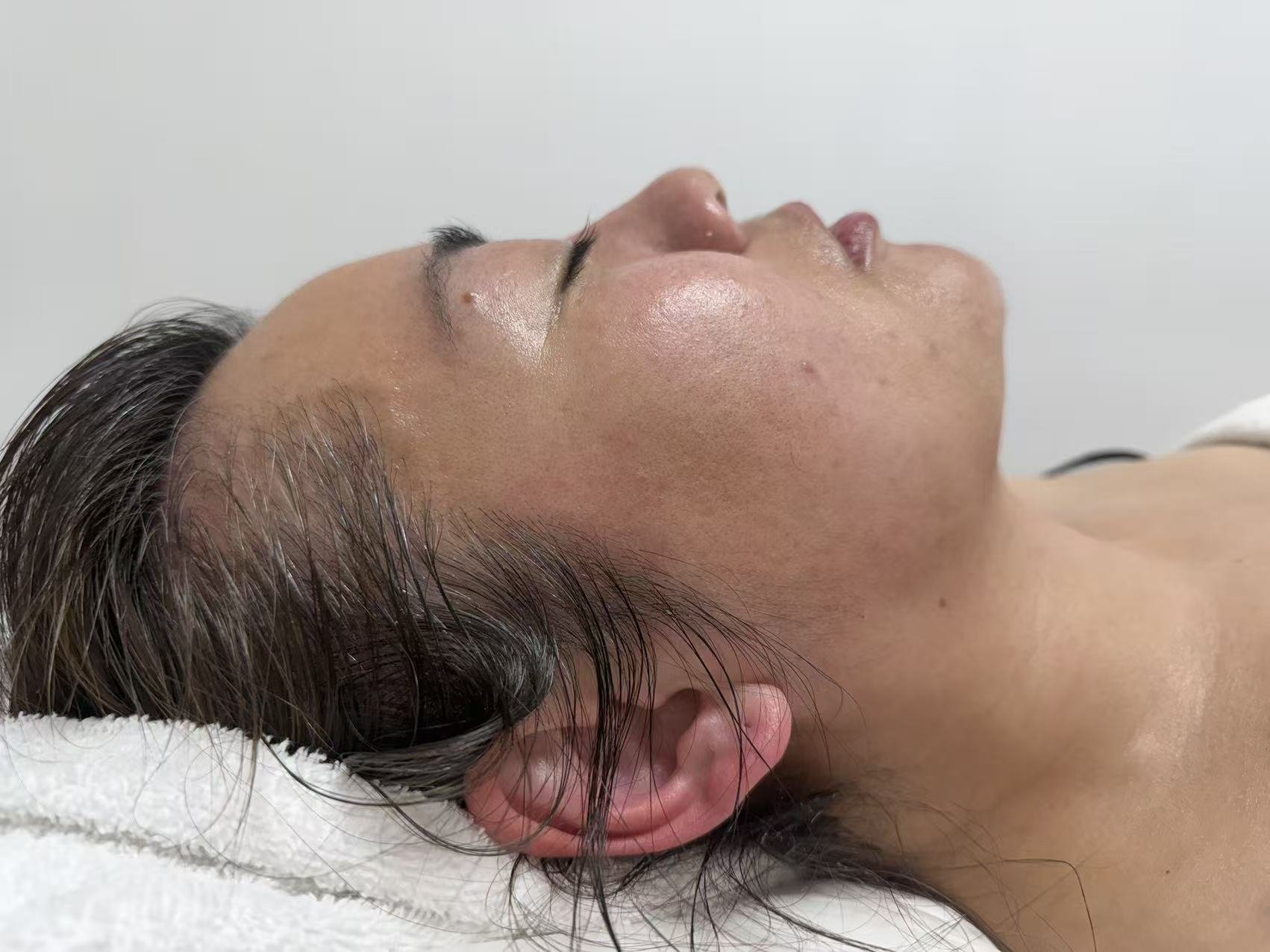 Manual Facial Reshaping & Contouring