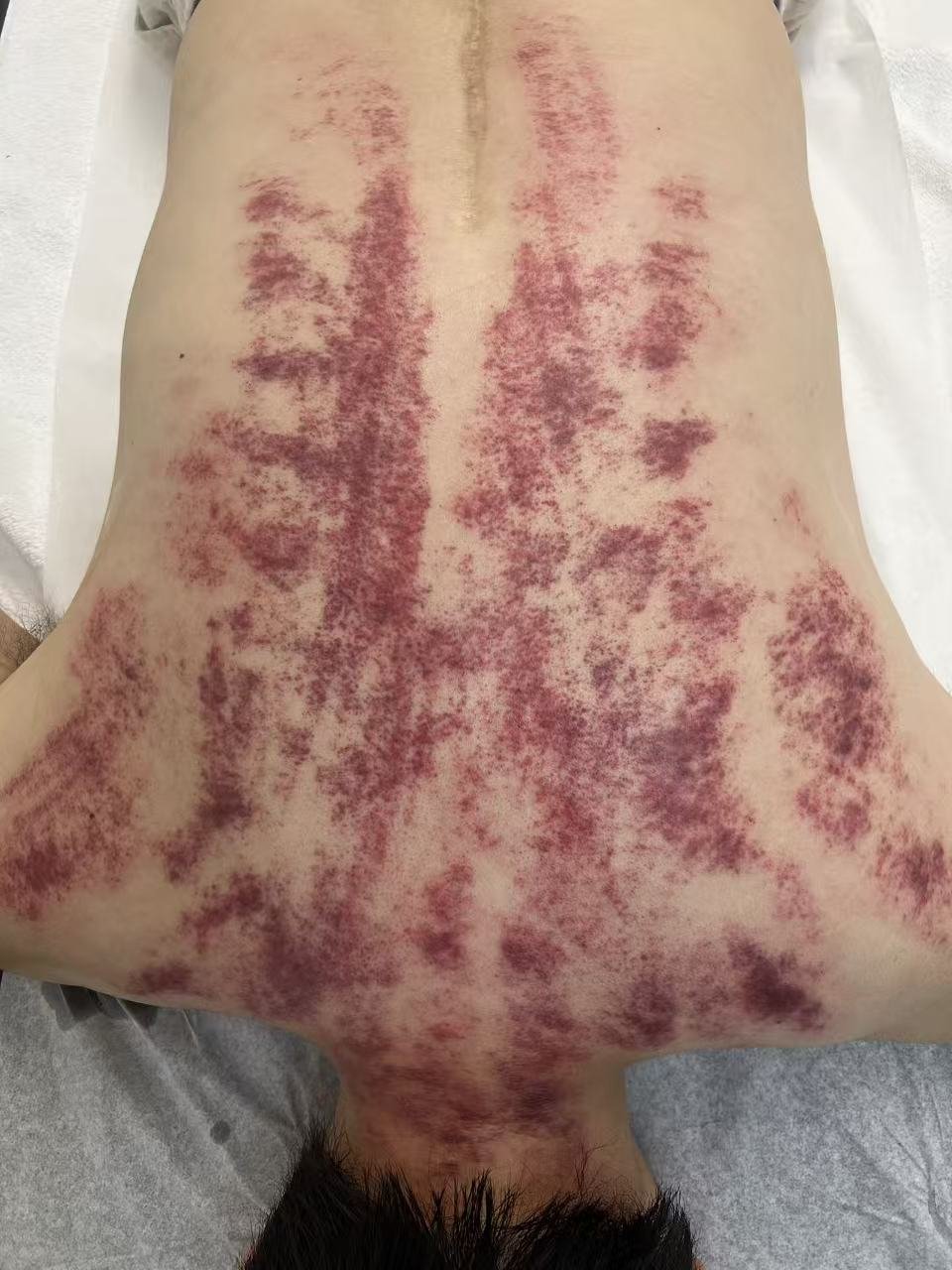 Gua Sha