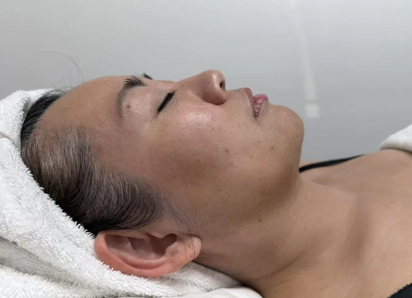 Manual Facial Reshaping & Contouring