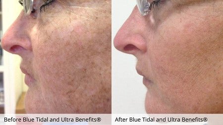 2013-UltraBenefitsand_BlueTidalEnzymeTreatments-Jodi_1024x1024.jpeg