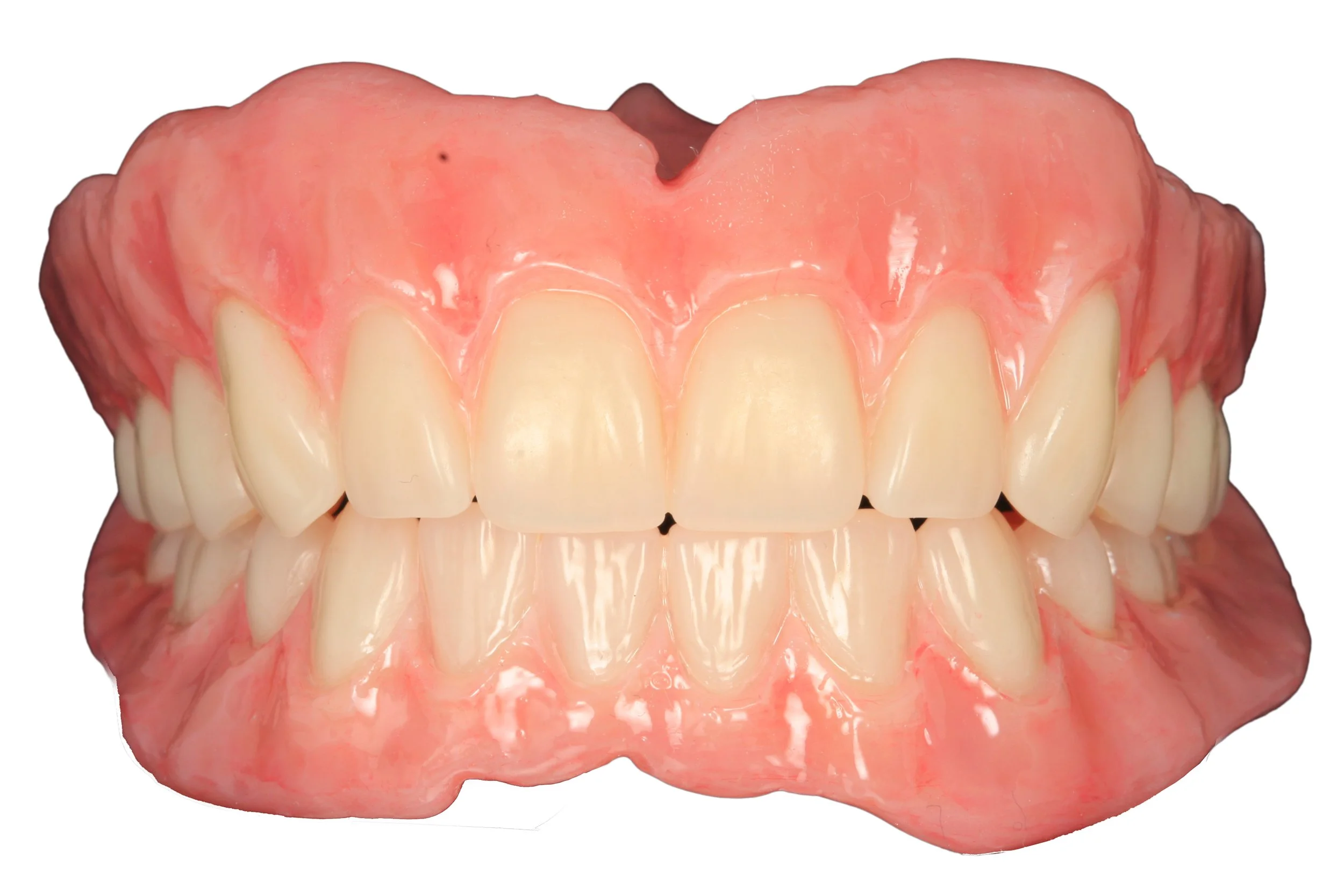 A dental prosthetic or denture showing upper and lower sets of artificial teeth with pink gum-colored base.