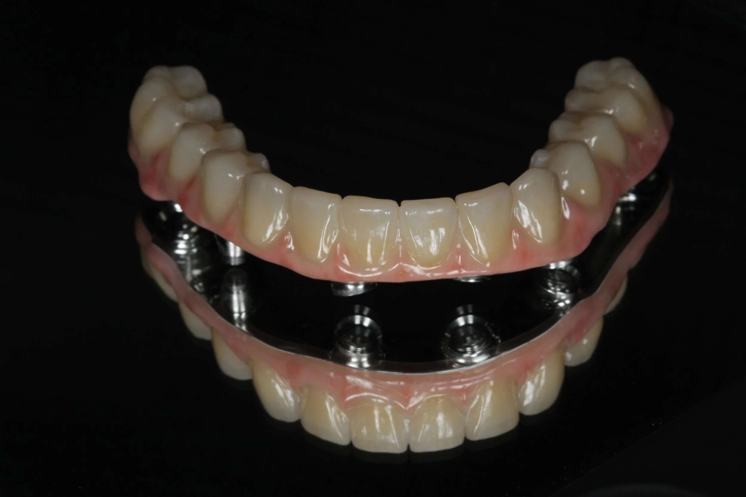 All on x- finish with Zirconia