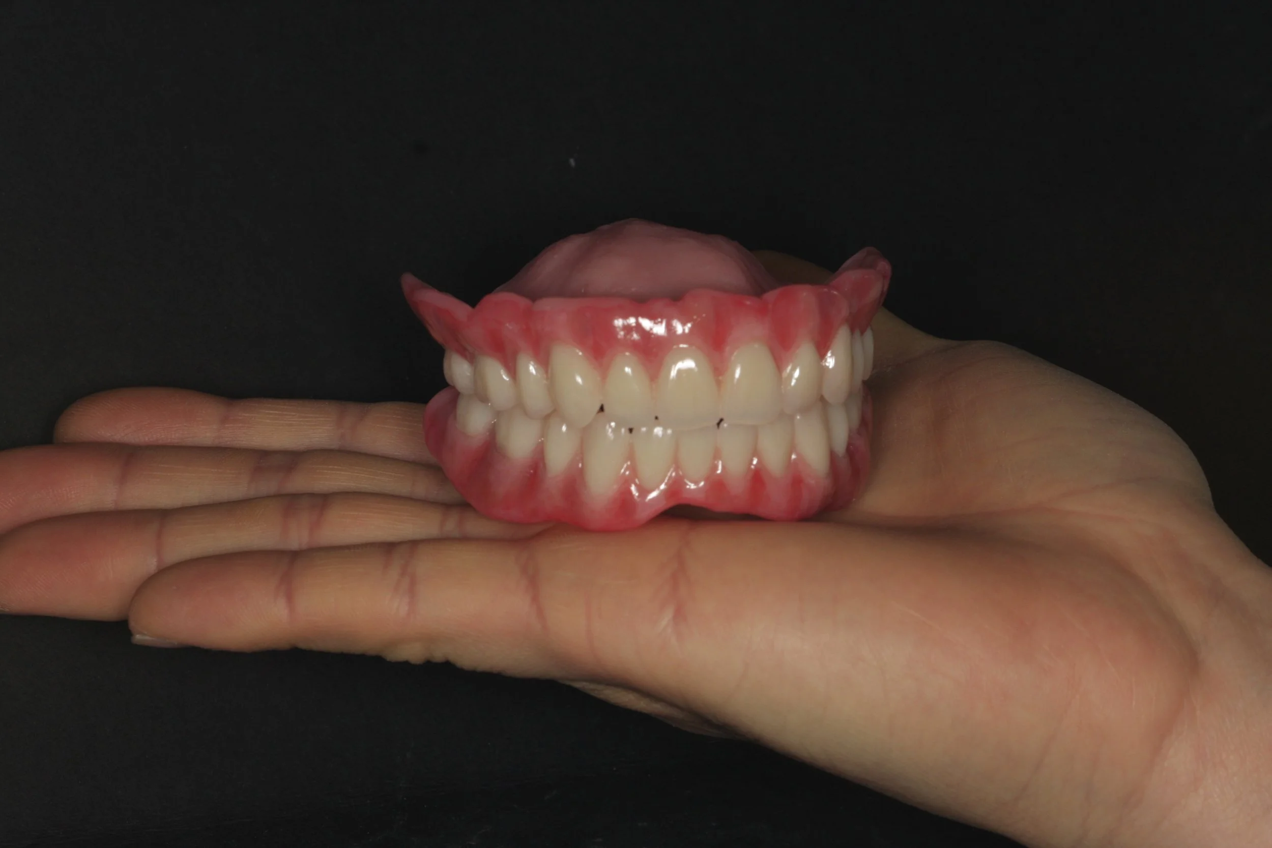 Full denture with Ivoclar phonares and nexco finish