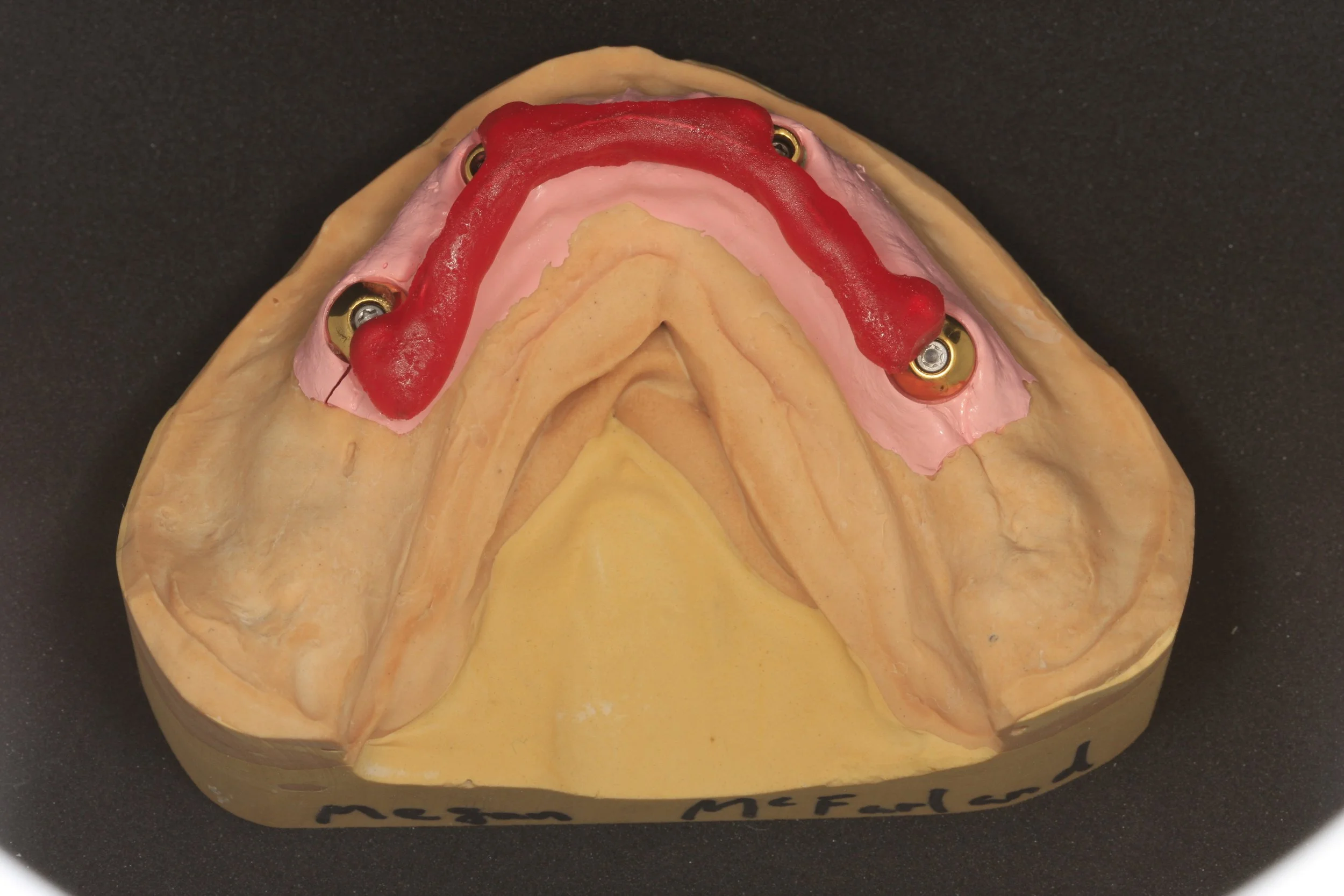 Zig for custom abutment insertion