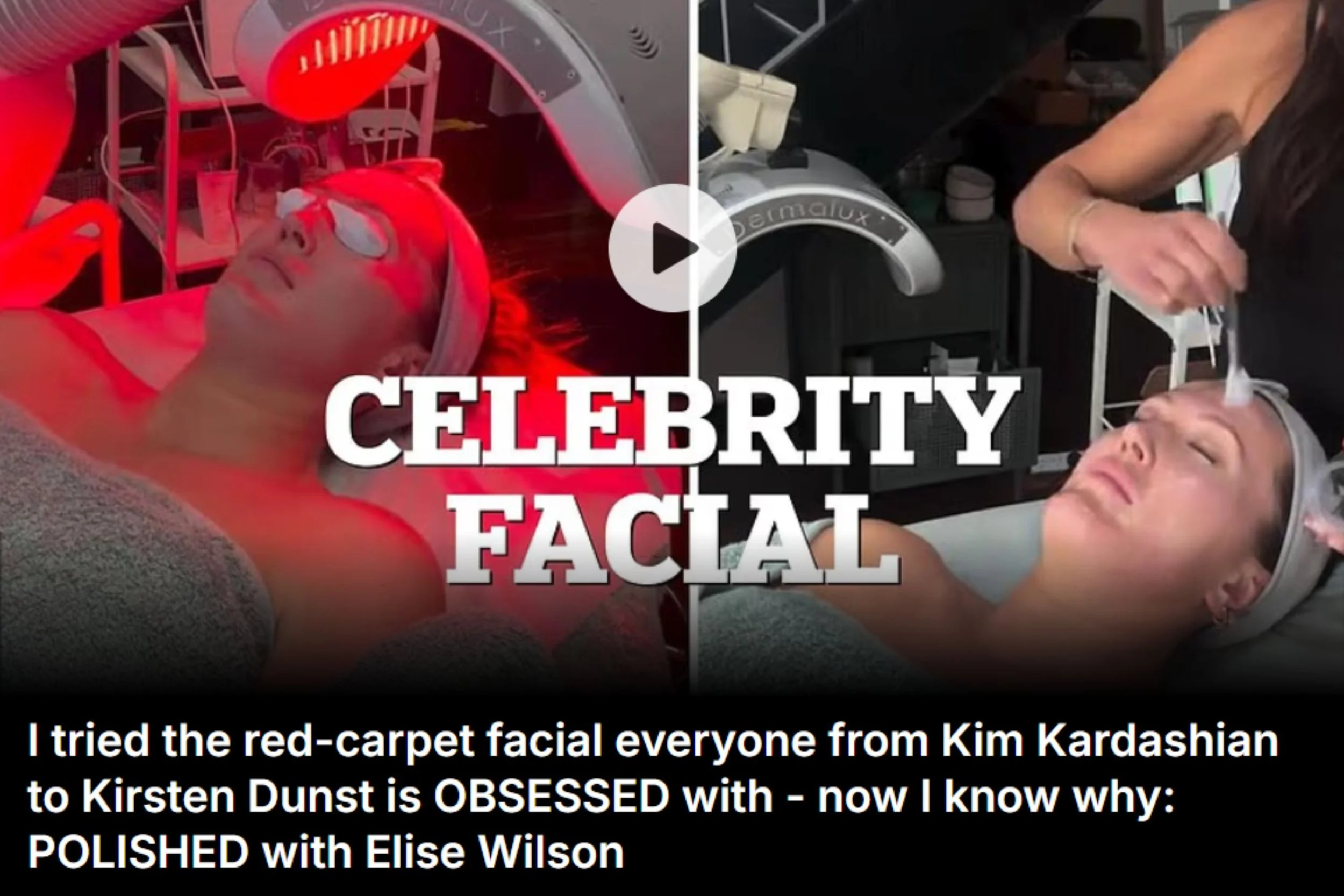 Daily Mail Dubs Pro2Lift “Every Celebrity’s Red-Carpet Gospel”
