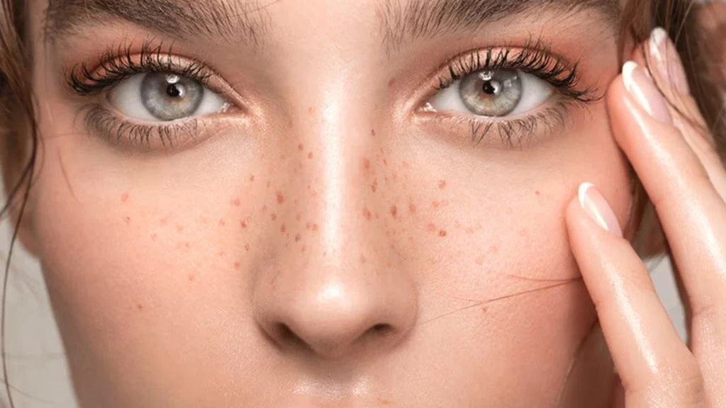 FRECKLES TRENDING: Why Are They The Most Sought after Beauty Trend of Spring.